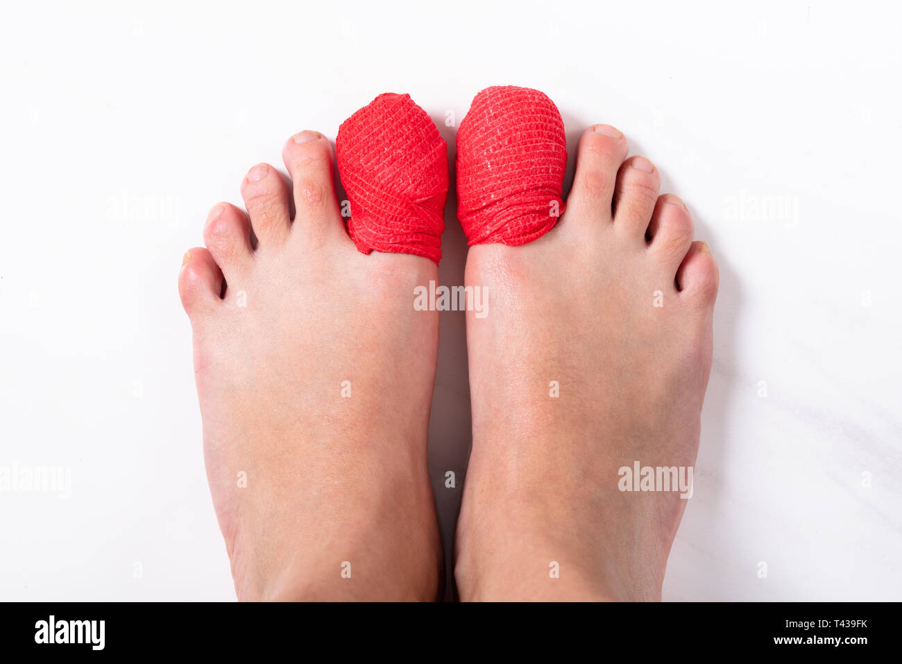 Close-up des menschlichen Beines mit roten Verband auf Wunde Toe Nail Stockfoto