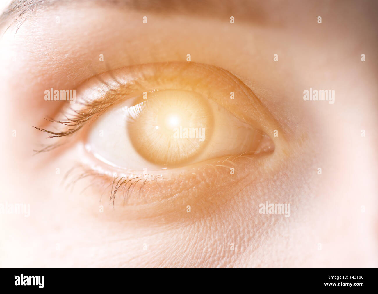Sonne im menschlichen Auge. Konzept Bild. Stockfoto