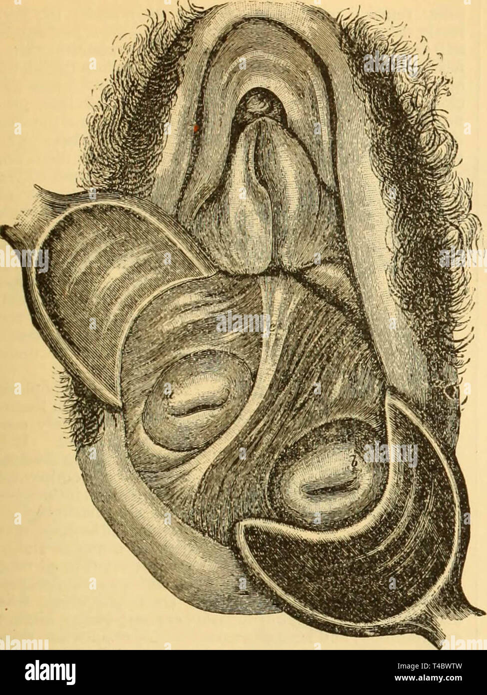 "Eine Referenz Handbuch der medizinischen Wissenschaften: umfassen das gesamte Spektrum der wissenschaftlichen und praktischen Medizin und verwandter Naturwissenschaften' (1885) Stockfoto