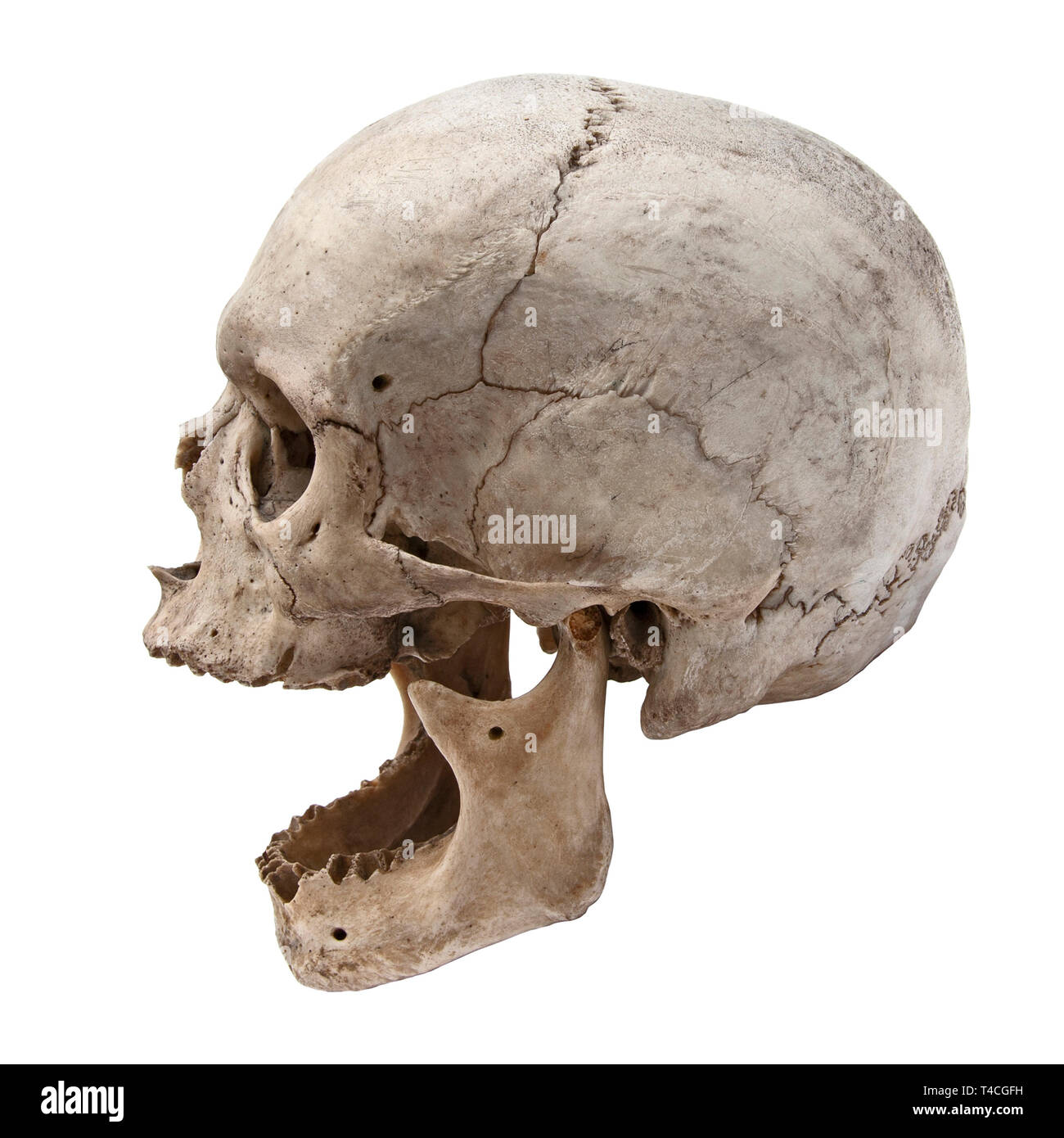 Alten menschlichen Schädel, Ansicht von der Seite ohne Zähne Stockfoto