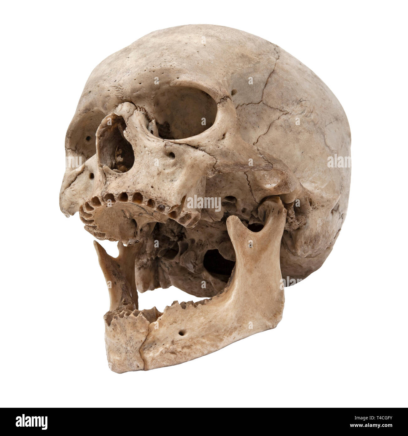 Alten menschlichen Schädel, Ansicht von unten ohne Zähne Stockfoto