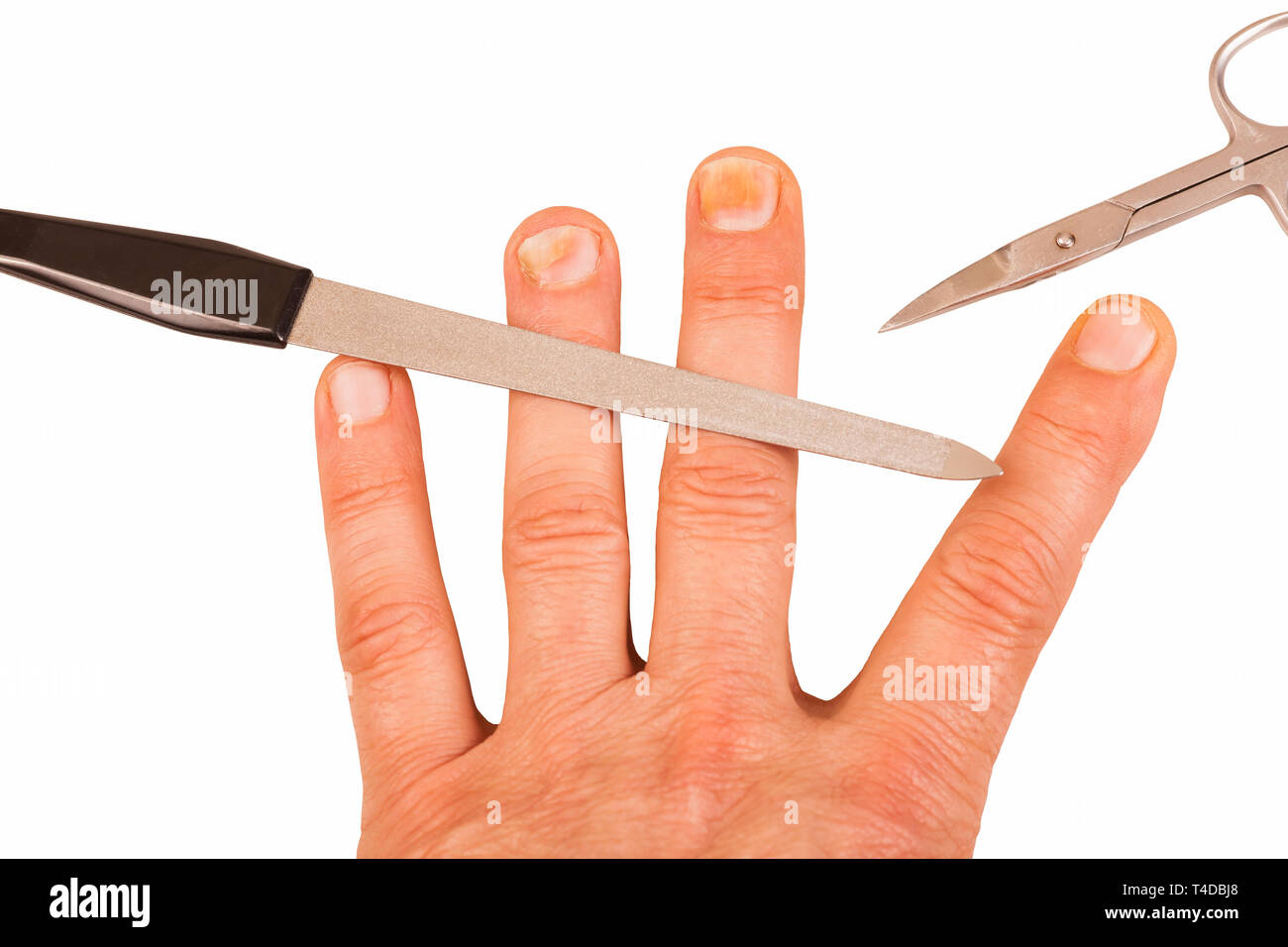 Fingernägel mit Nagelpilz Stockfoto