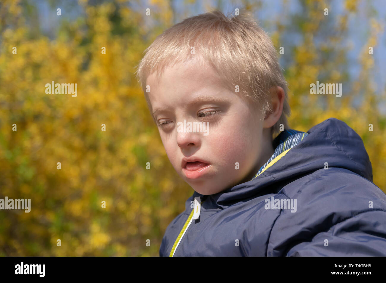 Mangels, Kinderbetreuung, Medizin und Personen Konzept: blonde Junge mit Down-syndrom spielen in einem Park im Frühling. Stockfoto