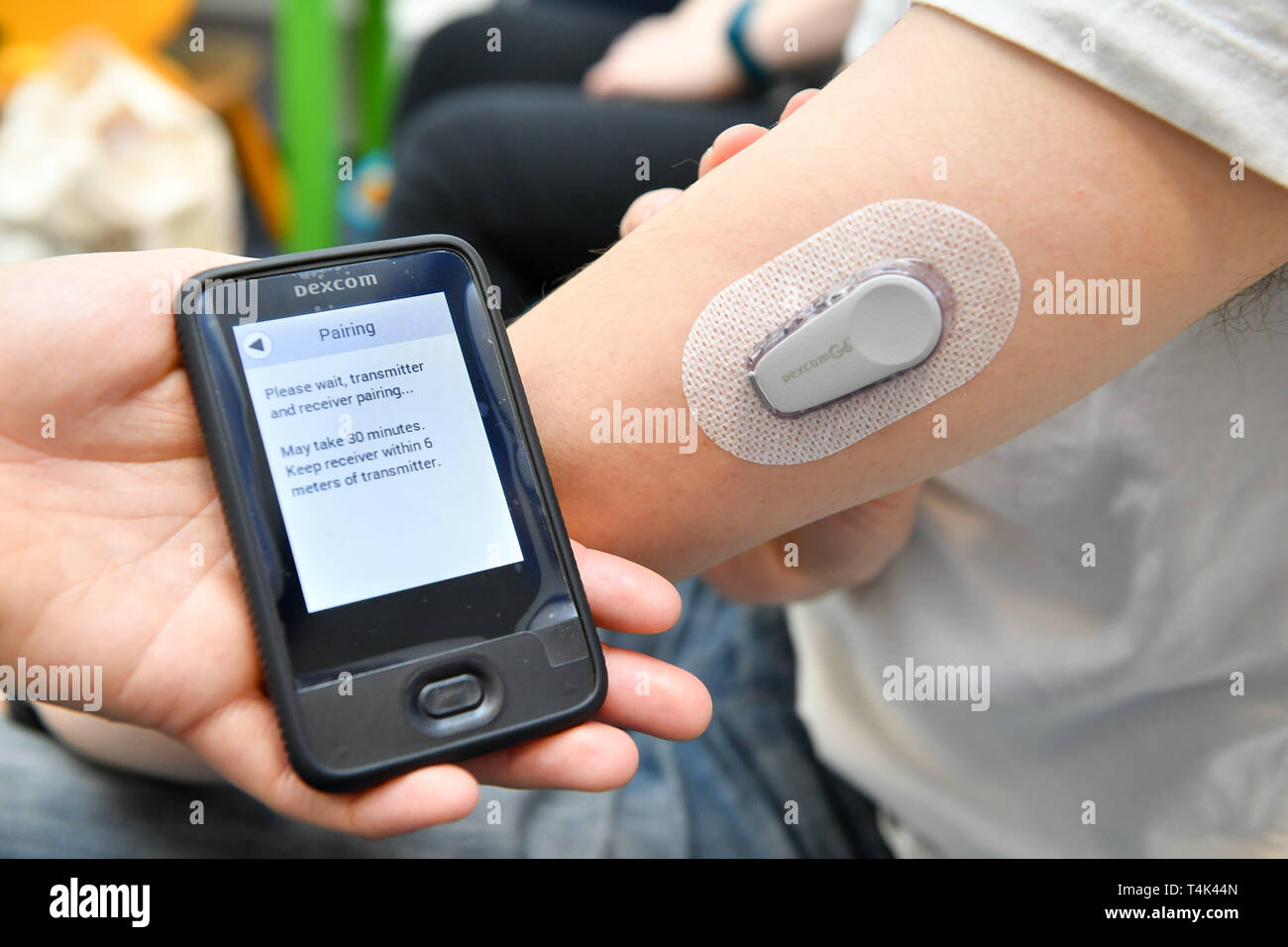Ein dexcom G6 Continuous Glucose Monitoring (CGM) ist an den Arm eines  Patienten in einem Medizinischen Klinik fest, die an der Universität von  Bristol. PRESS ASSOCIATION Foto. Bild Datum: Montag, 8. April