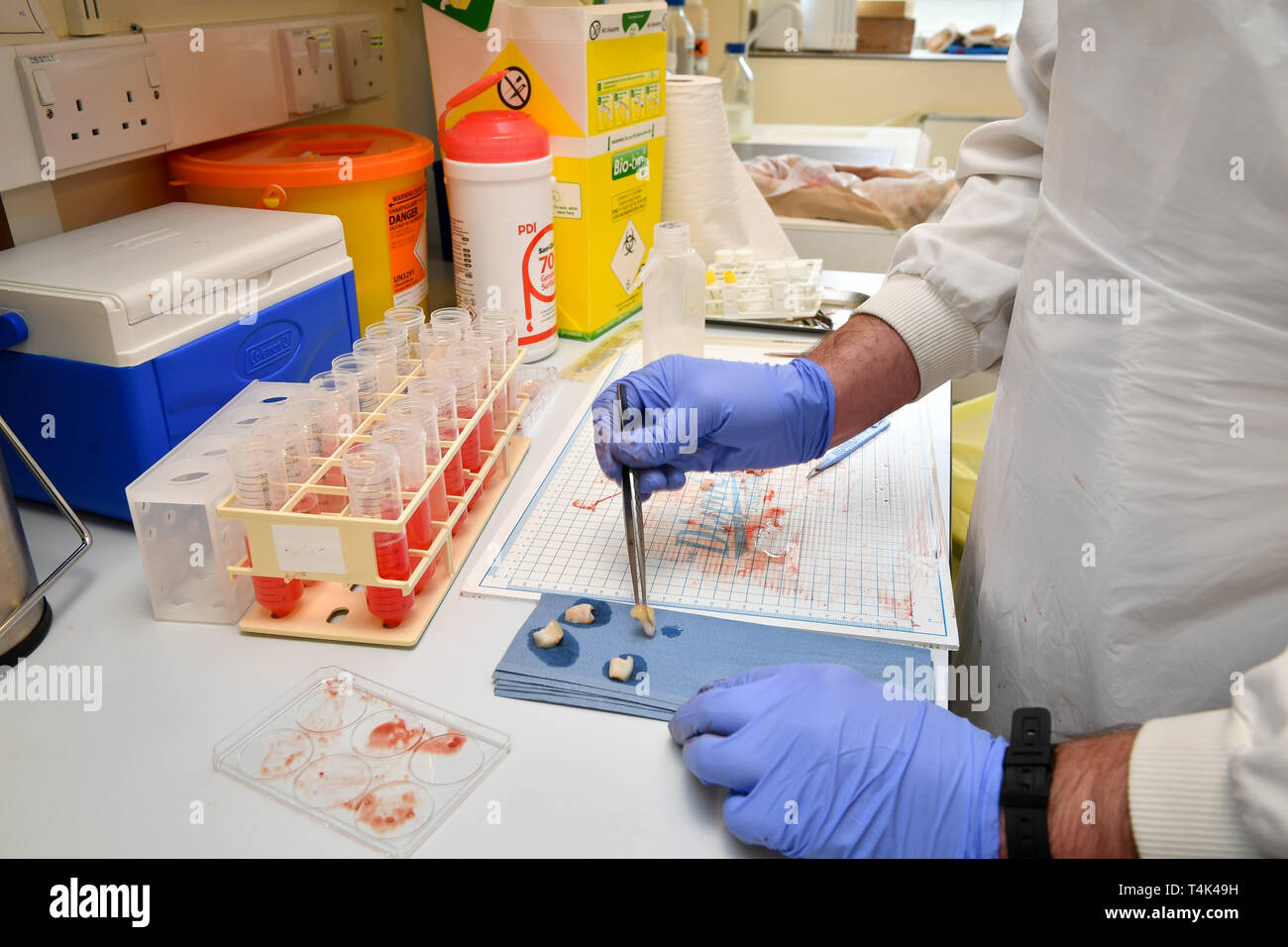 Hinweis: ANSTÖSSIGE INHALTE ALS MENSCHLICHE GEWEBE werden SEZIERT einen menschlichen Nabelschnur wird mit einem Skalpell in einem medizinischen klinischen Labor an der Universität von Bristol basierte SEZIERT. PRESS ASSOCIATION Foto. Bild Datum: Montag, 8. April 2019. Photo Credit: Ben Birchall Stockfoto