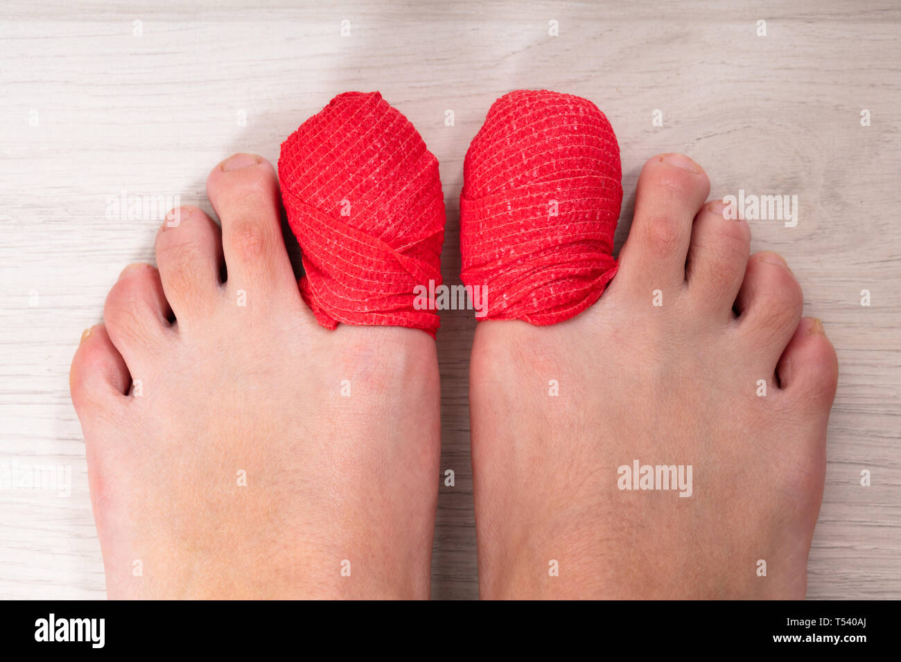 Close-up des menschlichen Beines mit roten Verband auf Wunde Toe Nail Stockfoto