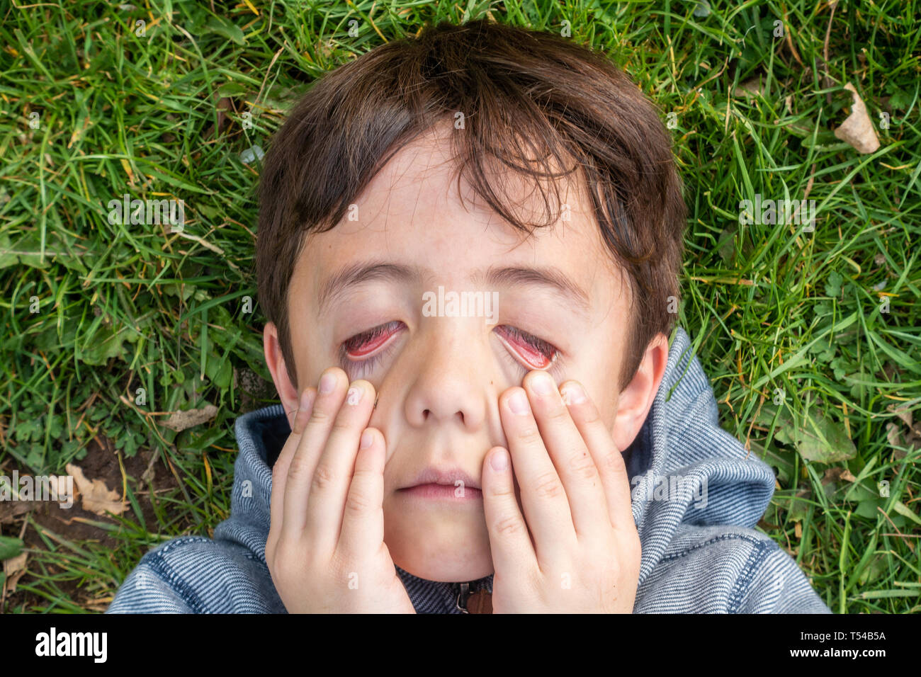 Ein kleiner Junge liegt auf Gras und zieht seinen unteren Lidstrich unten. Stockfoto