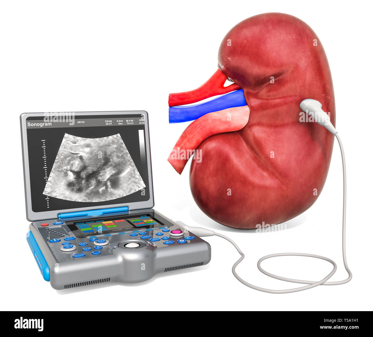 Niere Ultraschall Konzept. Menschliche Niere mit medizinischen Ultraschall Diagnose Maschine, 3D-Rendering auf weißem Hintergrund Stockfoto