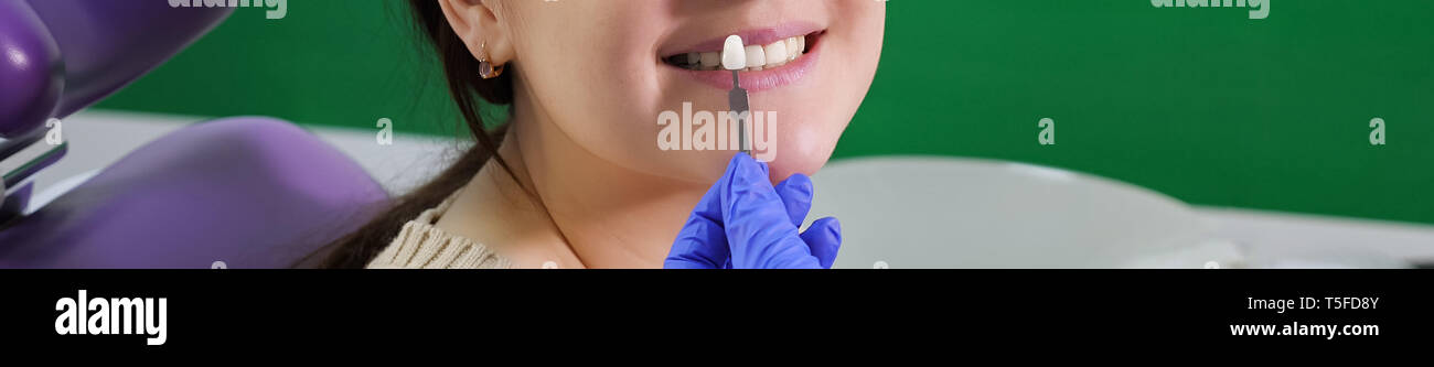 Zahnarzt mit Zahn Farbmuster ist die Wahl Schatten für Frauen Patienten Zähne in der Zahnarztpraxis. Junge Frau, Porträt, Nahaufnahme Stockfoto