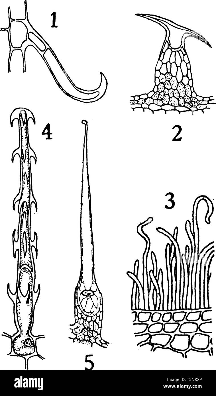 Ein Bild mit verschiedenen Formen der epidermalen Auswüchse, vintage Strichzeichnung oder Gravur Abbildung. Stock Vektor