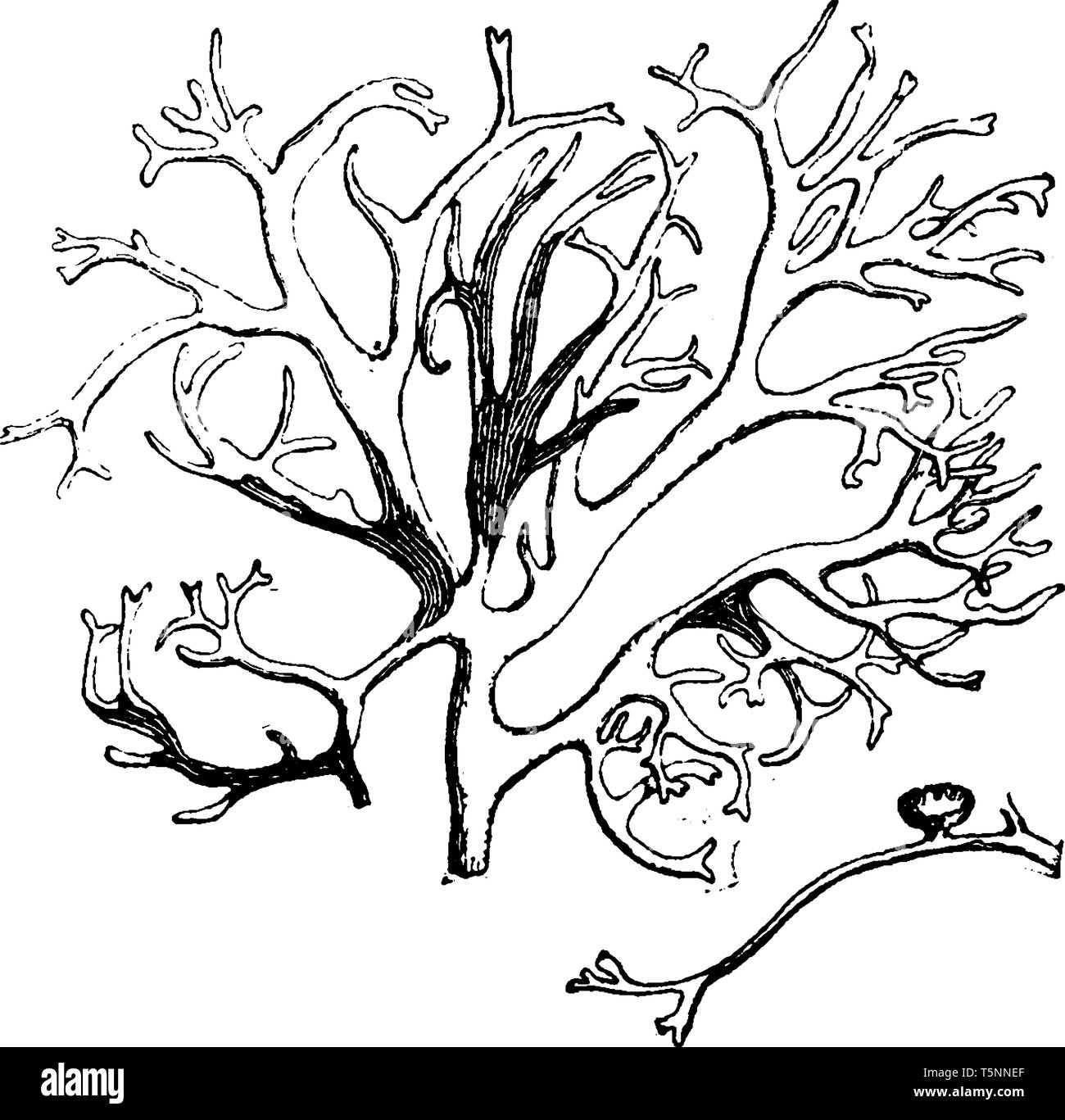 Ein Bild der Baum Moos mit einem pothecium. Dieser Baum Moos ist ein Pilz, wächst auf der Rinde von Tannen und Stifte, vintage Strichzeichnung oder Gravur illus Stock Vektor