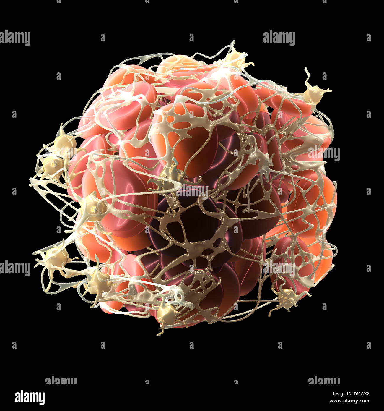 Thrombus im Blutstrom, Blutgerinnsel mit aktivierten Thrombozyten und Fibrin, Medizinisch 3D-Abbildung auf weißem Hintergrund Stockfoto