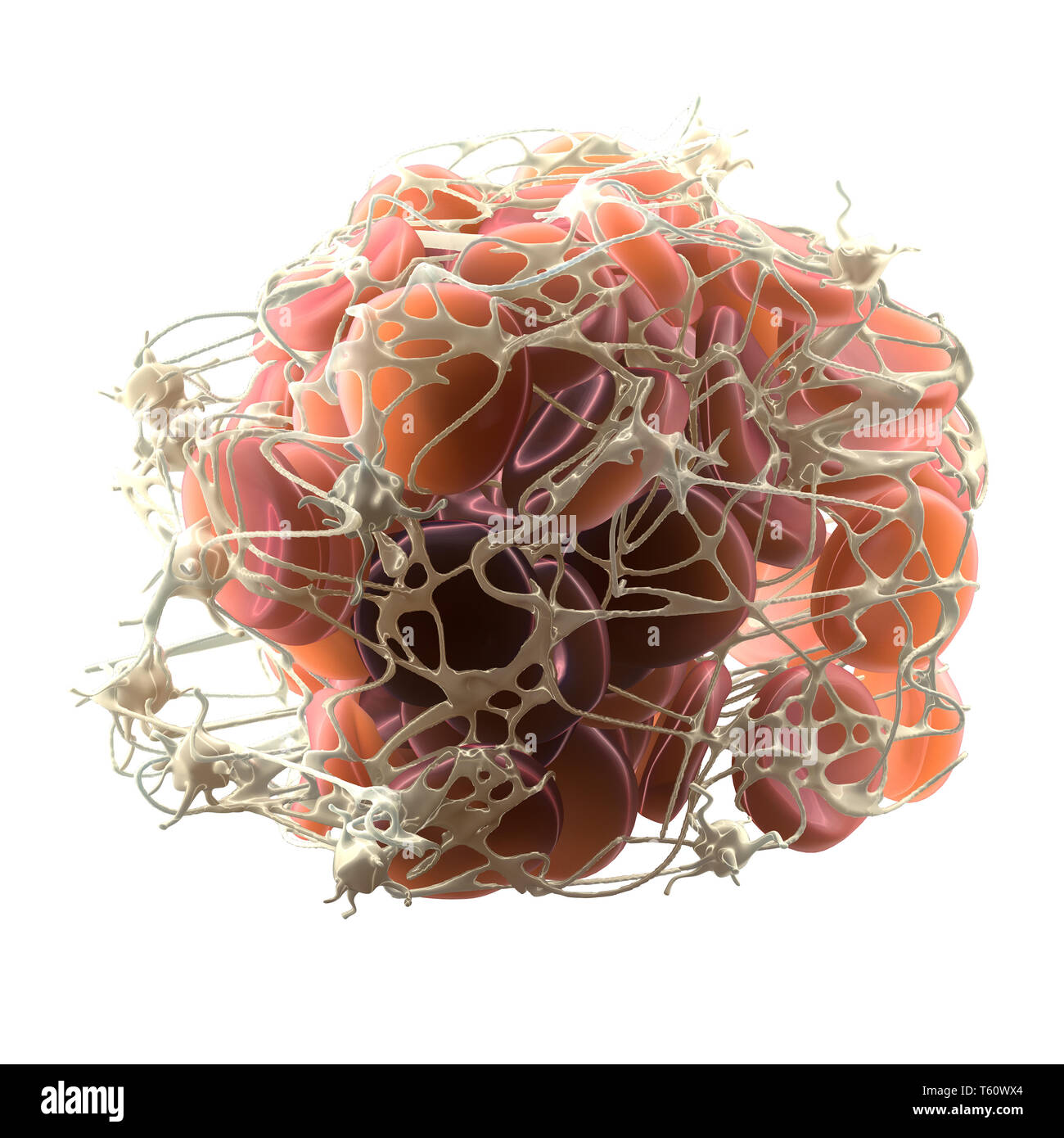 Thrombus im Blutstrom, Blutgerinnsel mit aktivierten Thrombozyten und Fibrin, Medizinisch 3D-Abbildung auf weißem Hintergrund Stockfoto