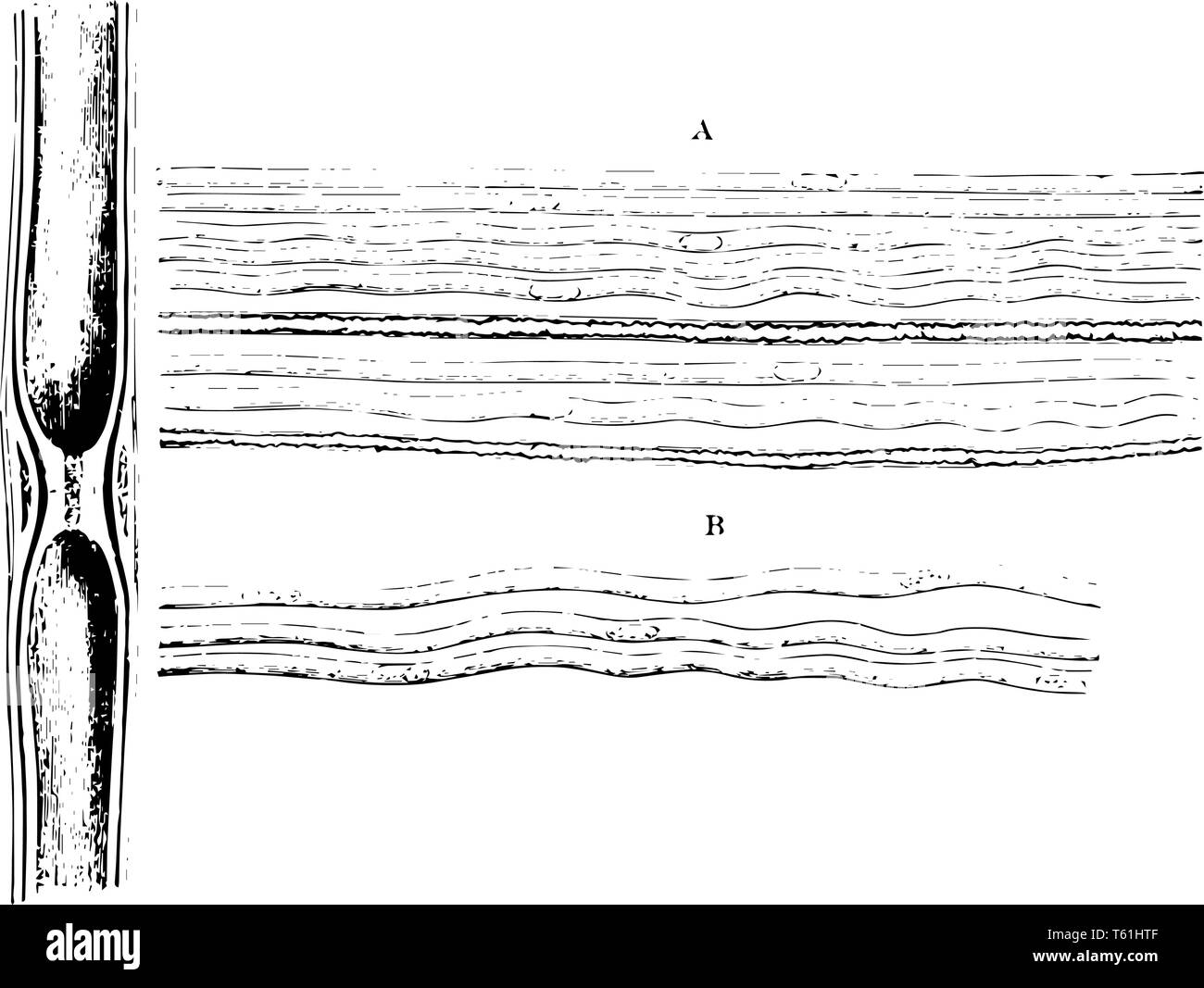 Gallertartige Nervenfasern aus einem Zweig der olfaktorischen Nerv der Schafe vintage Strichzeichnung oder Gravur Abbildung. Stock Vektor