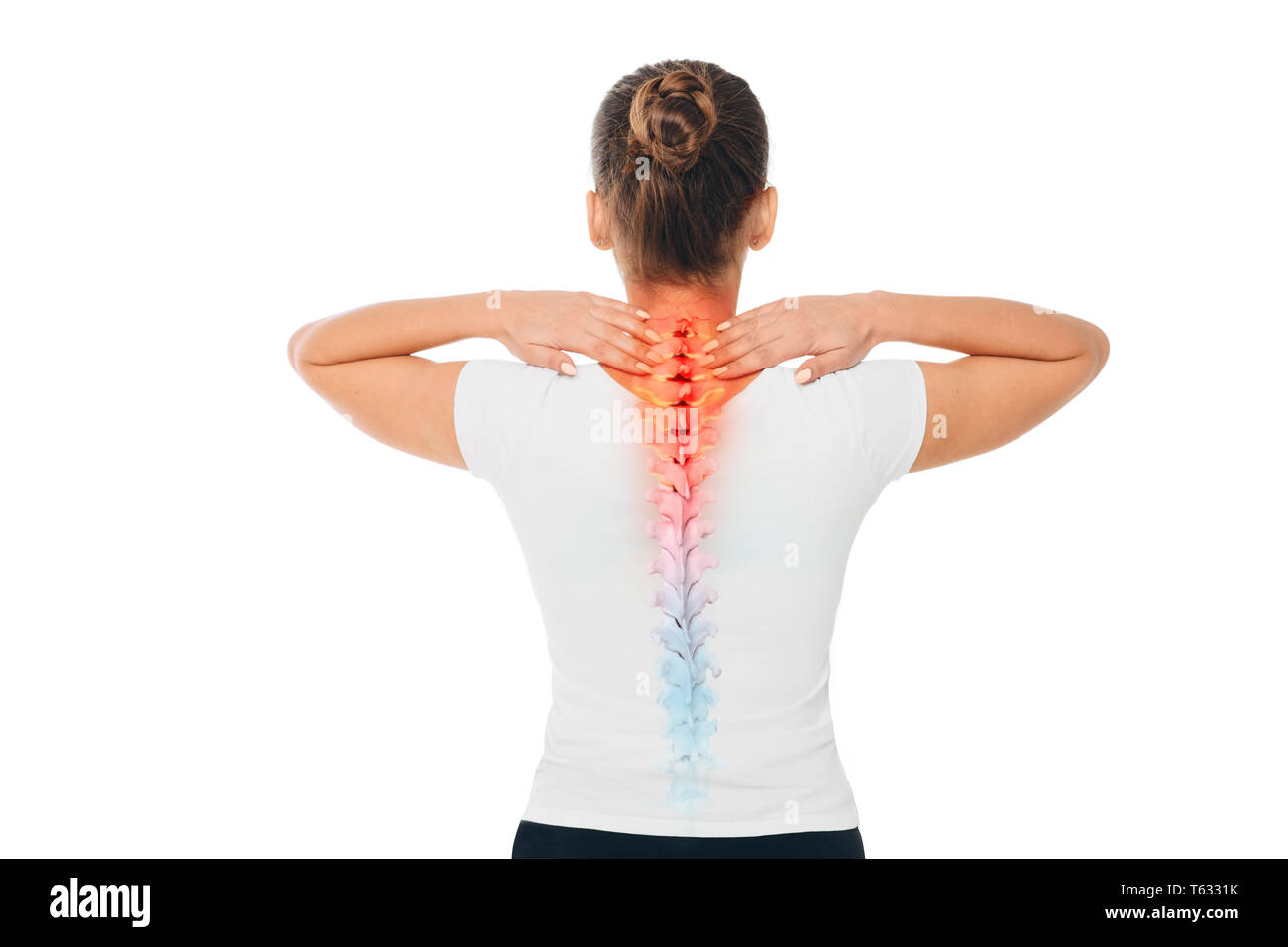 Schmerzen in der Wirbelsäule. Composite von Bild der Wirbelsäule und der weiblichen zurück mit Rückenschmerzen. Stockfoto