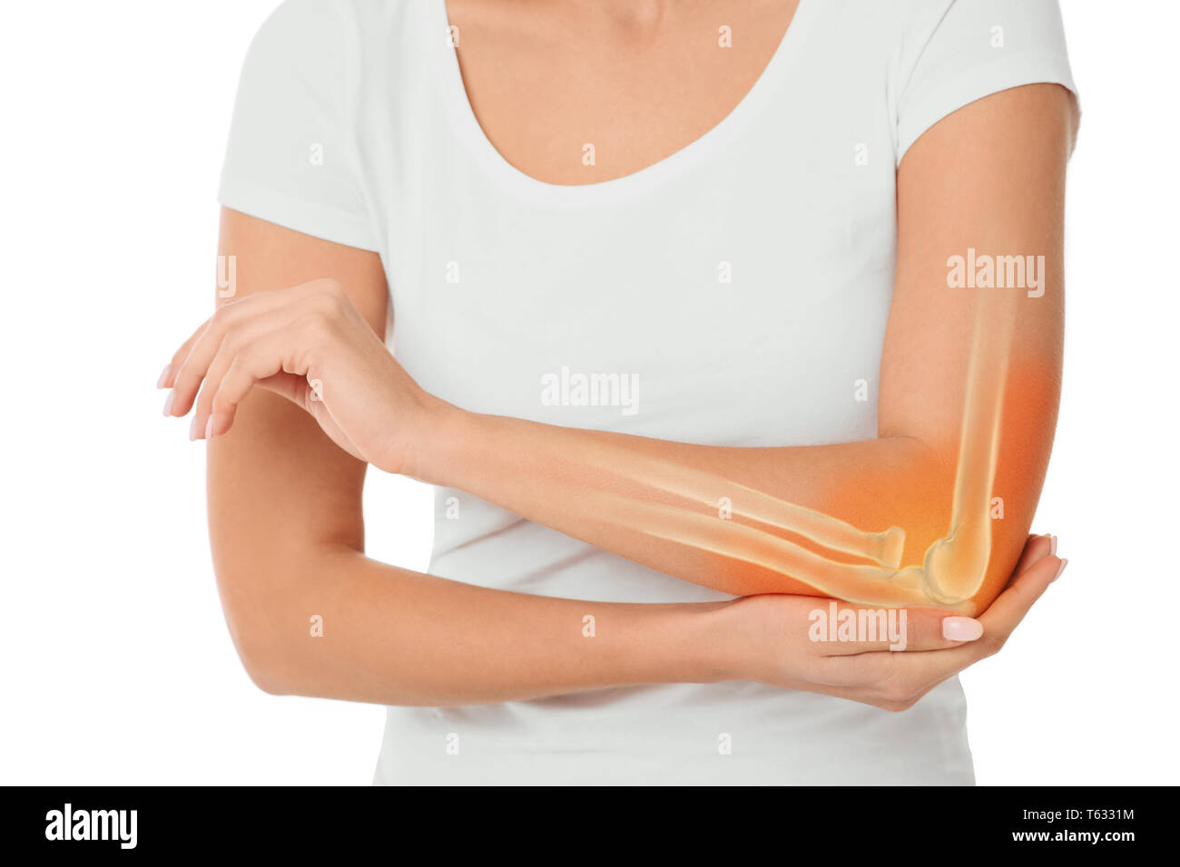 Frau Schmerzen im Ellenbogen. Composite image arm Knochen und Winkelstück Stockfoto