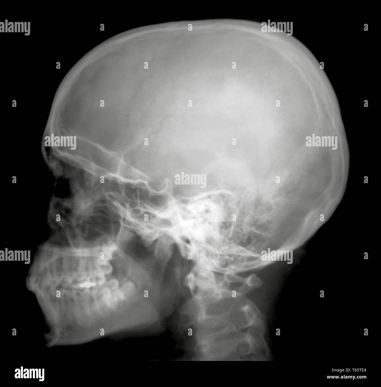 X-Ray Profil Stockfoto
