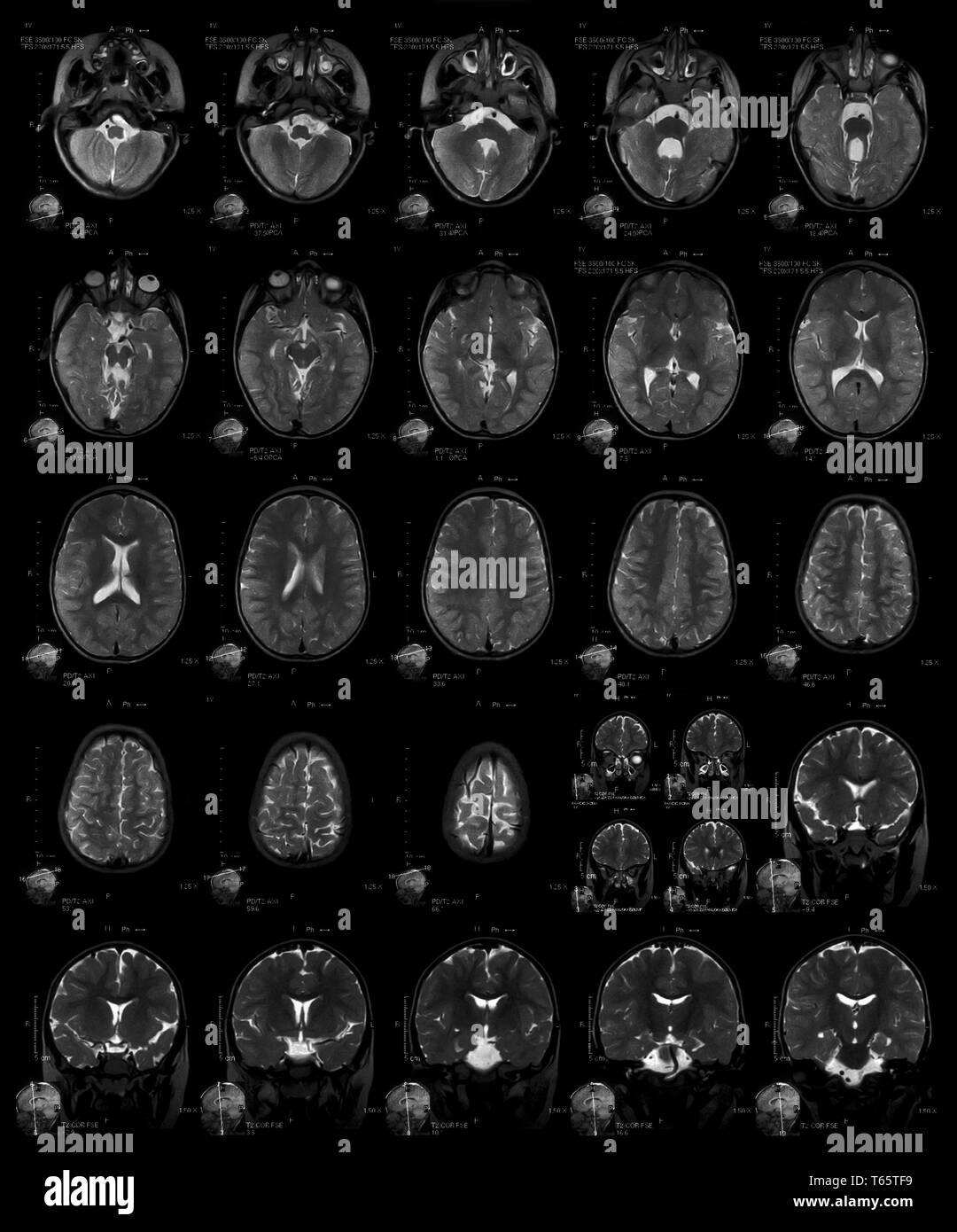 X-ray Stockfoto