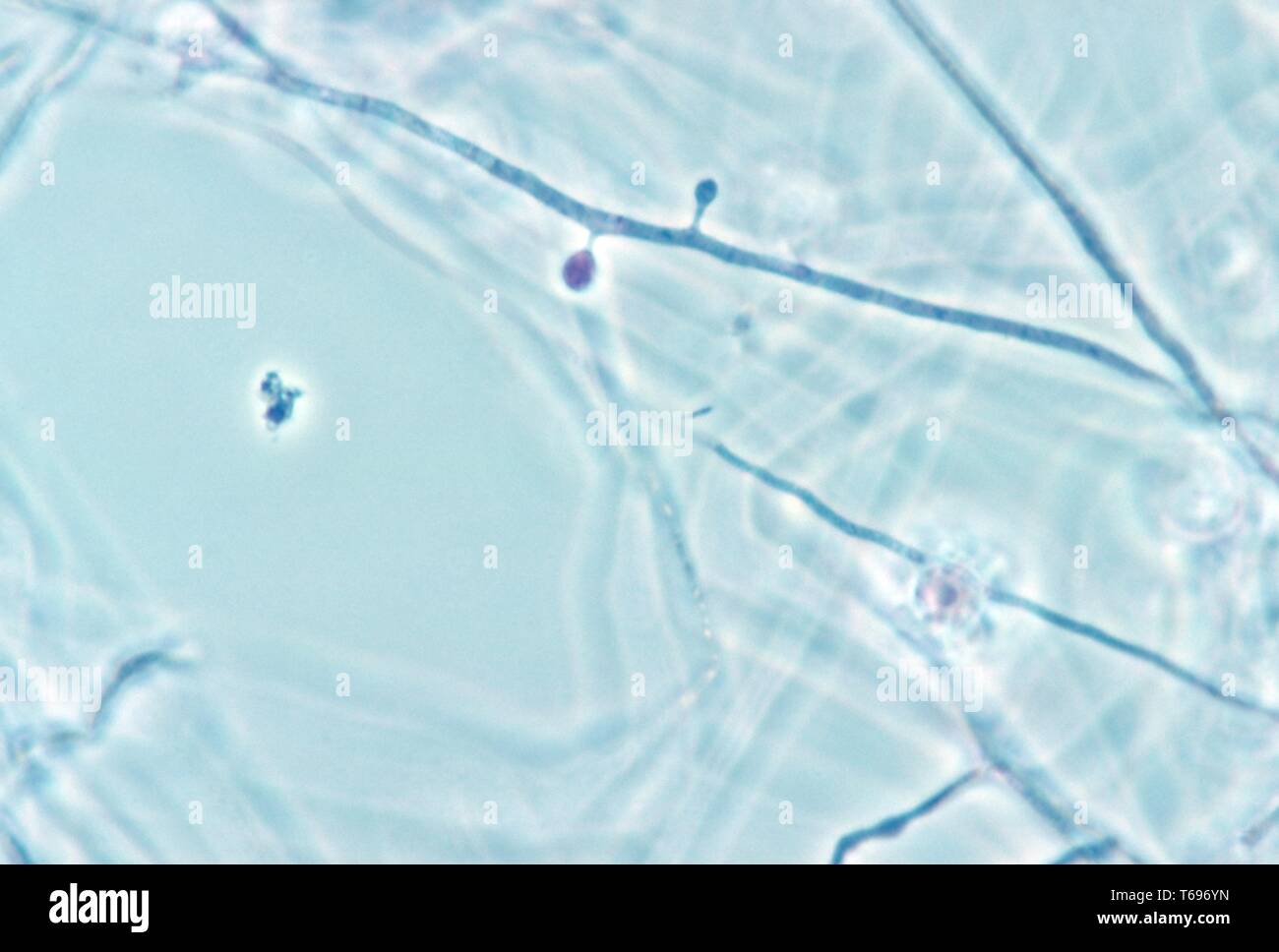 Der Photomicrograph microconidia der dimorphic Pilz Histoplasma capsulatum, 1961. Bild mit freundlicher Genehmigung Zentren für Krankheitskontrolle und Prävention (CDC)/Dr Lucille K. Georg. () Stockfoto