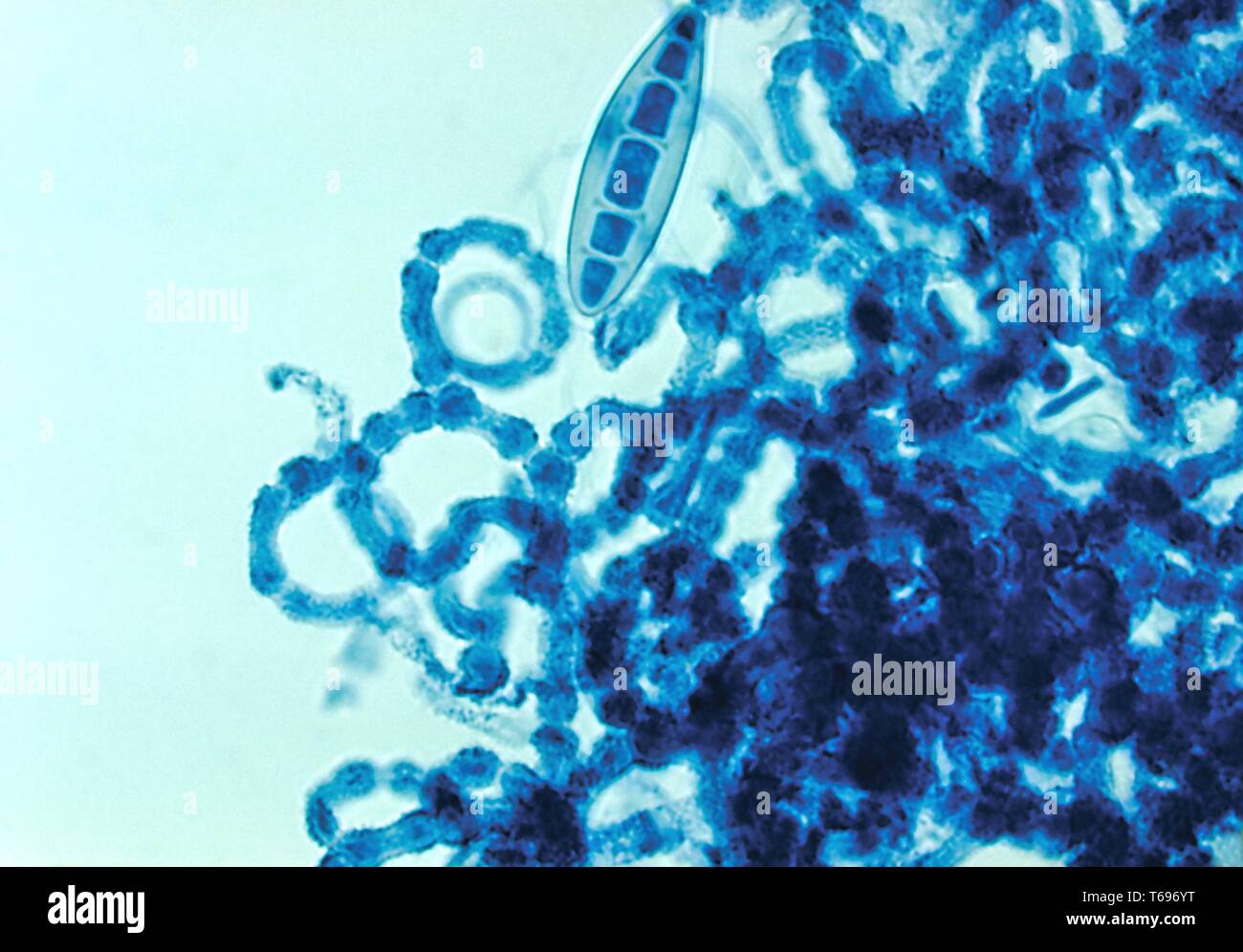 Photomicrograph der Rand eines gescheiterten cleistothecium der Trichophyton ajelloi Pilz, 1961. Bild mit freundlicher Genehmigung Zentren für Krankheitskontrolle und Prävention (CDC)/Dr Lucille K. Georg. () Stockfoto