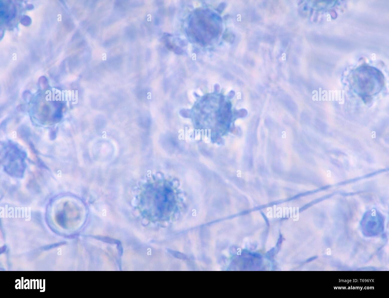 Der mehrfache Photomicrograph macroconidia der Pilz Histoplasma capsulatum, 1963. Bild mit freundlicher Genehmigung Zentren für Krankheitskontrolle und Prävention (CDC)/Dr Libero Ajello. () Stockfoto