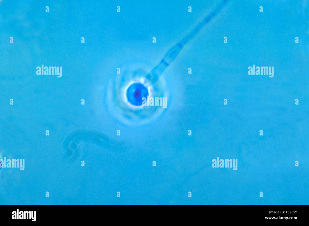 Der Photomicrograph conidiophore der Pilz Histoplasma capsulatum, 1963. Bild mit freundlicher Genehmigung Zentren für Krankheitskontrolle und Prävention (CDC)/Dr Libero Ajello. () Stockfoto