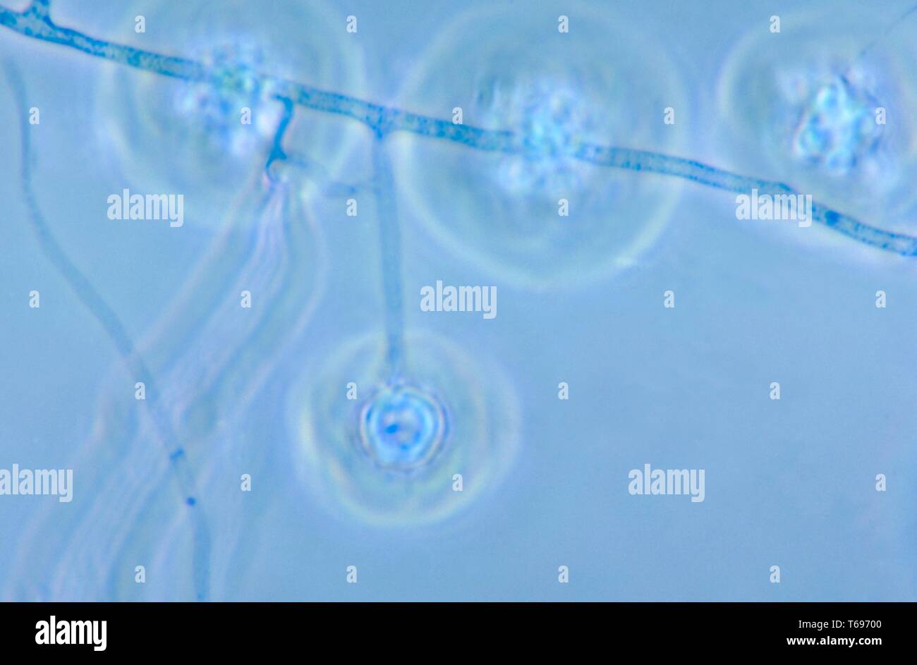 Der mehrfache Photomicrograph conidiophores der Pilz Histoplasma capsulatum, 1963. Bild mit freundlicher Genehmigung Zentren für Krankheitskontrolle und Prävention (CDC)/Dr Libero Ajello. () Stockfoto