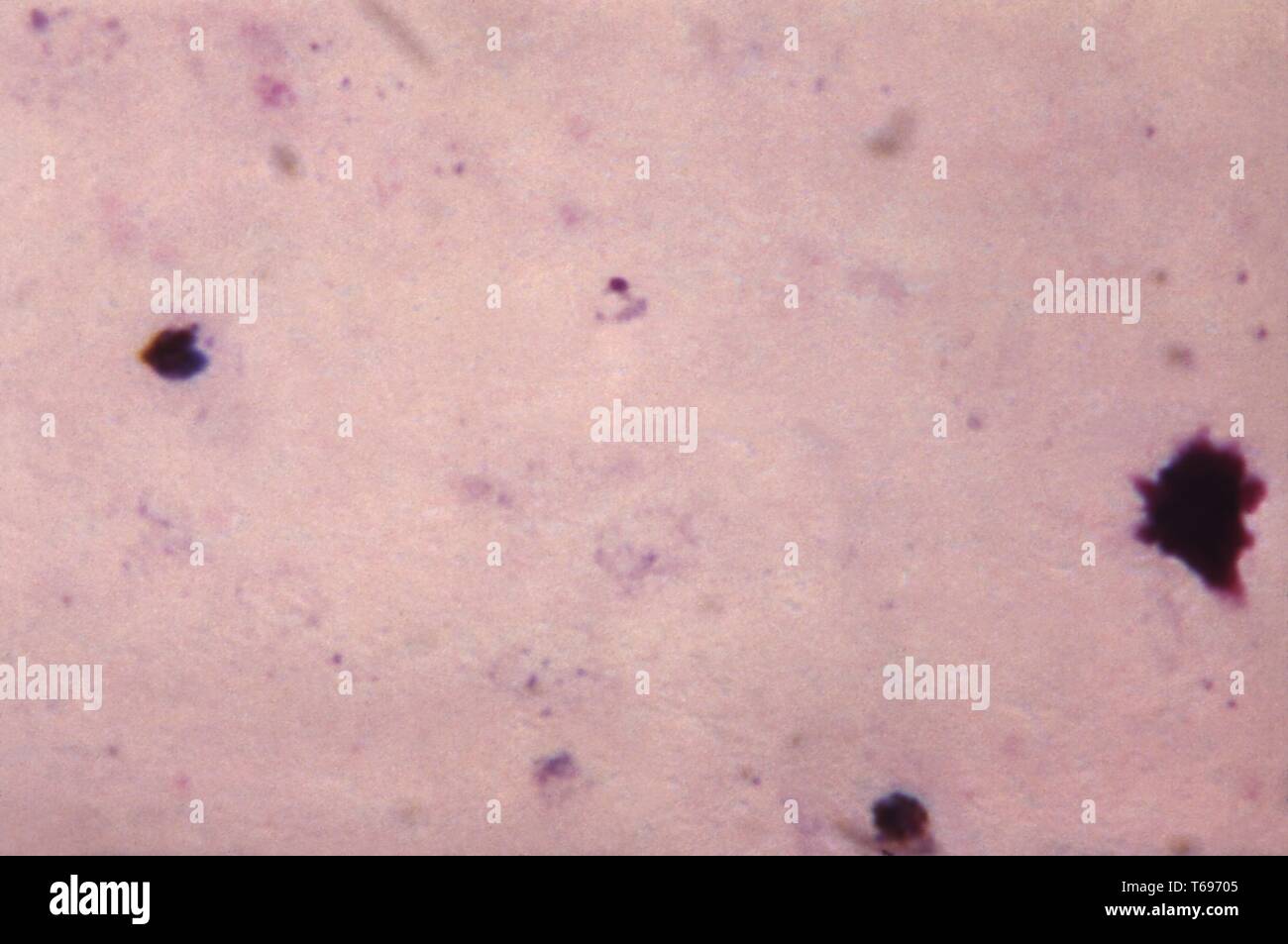 Dickschicht photomicrograph einer jungen wachsenden Plasmodium malariae trophozoite, 1965. Bild mit freundlicher Genehmigung Zentren für Krankheitskontrolle und Prävention (CDC)/Dr Mae Melvin. () Stockfoto