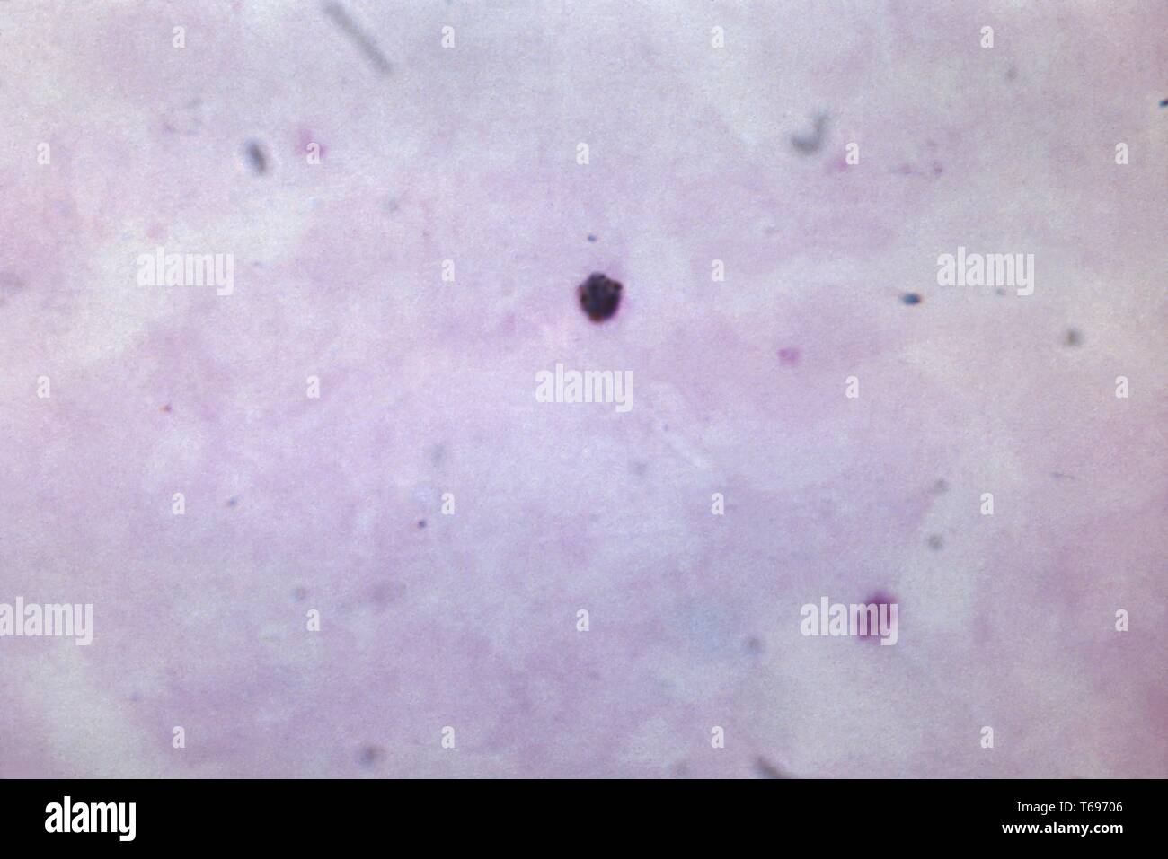 Dickschicht photomicrograph eines wachsenden Plasmodium malariae trophozoite, 1965. Bild mit freundlicher Genehmigung Zentren für Krankheitskontrolle und Prävention (CDC)/Dr Mae Melvin. () Stockfoto