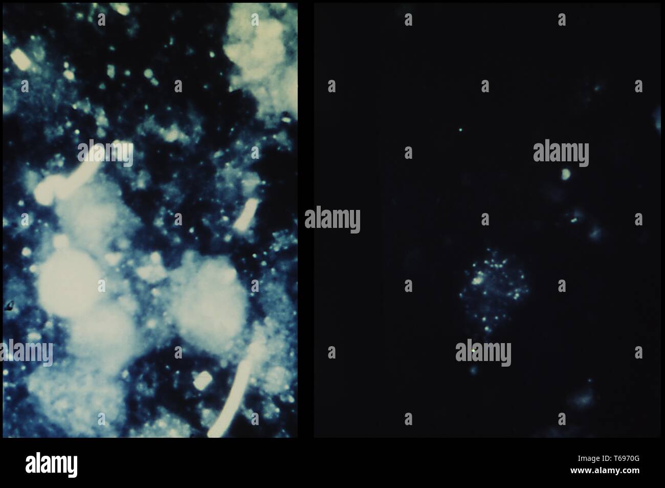 Photomicrograph des Lymphknotens Eindruck bestreichen, Bacillus anthracis (der Erreger von Milzbrand) auf der linken und nicht-infizierten Gewebe auf der rechten Seite, 1966. Bild mit freundlicher Genehmigung Zentren für Krankheitskontrolle und Prävention (CDC)/Sidney J. Benesky. () Stockfoto