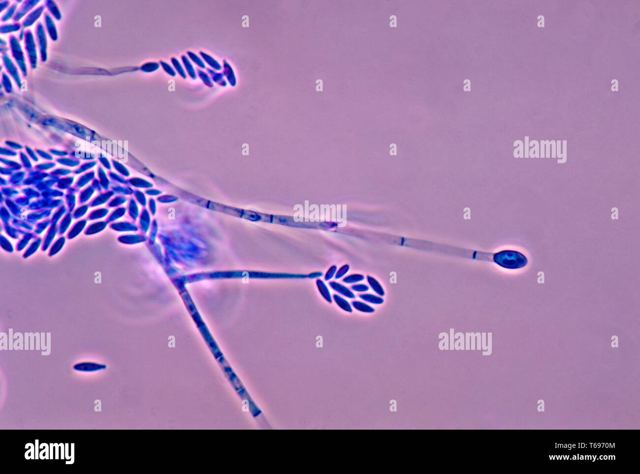 Photomicrograph der Konidien und conidiophores des Pilzes Fusarium verticillioides, 1978. Bild mit freundlicher Genehmigung Zentren für Krankheitskontrolle und Prävention (CDC)/Dr Libero Ajello. () Stockfoto