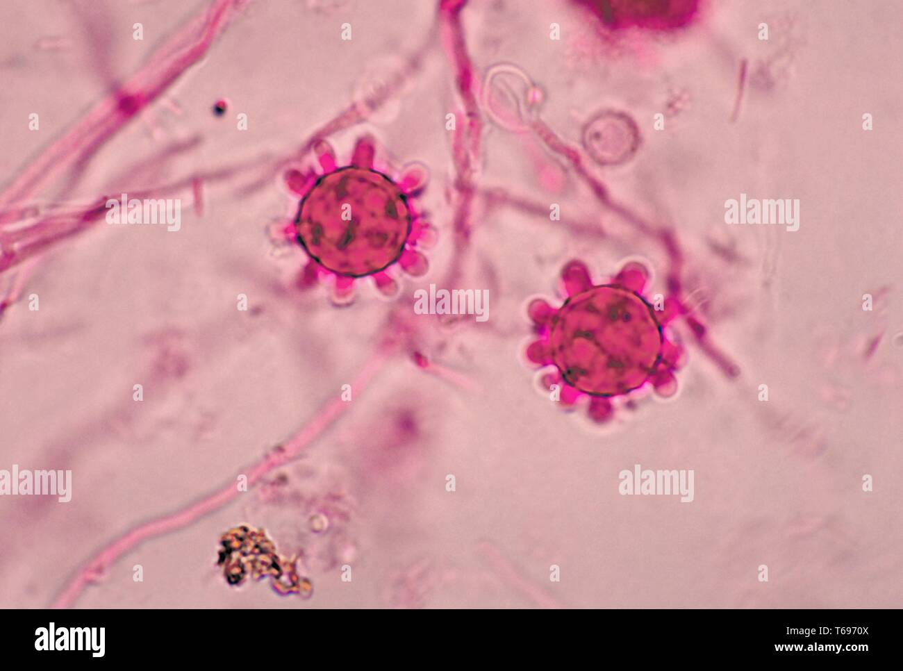 Photomicrograph der Jamaikanischen isolieren tuberculate macroconidia der dimorphic Pilz Histoplasma capsulatum, 1968. Bild mit freundlicher Genehmigung Zentren für Krankheitskontrolle und Prävention (CDC)/Dr Libero Ajello. () Stockfoto