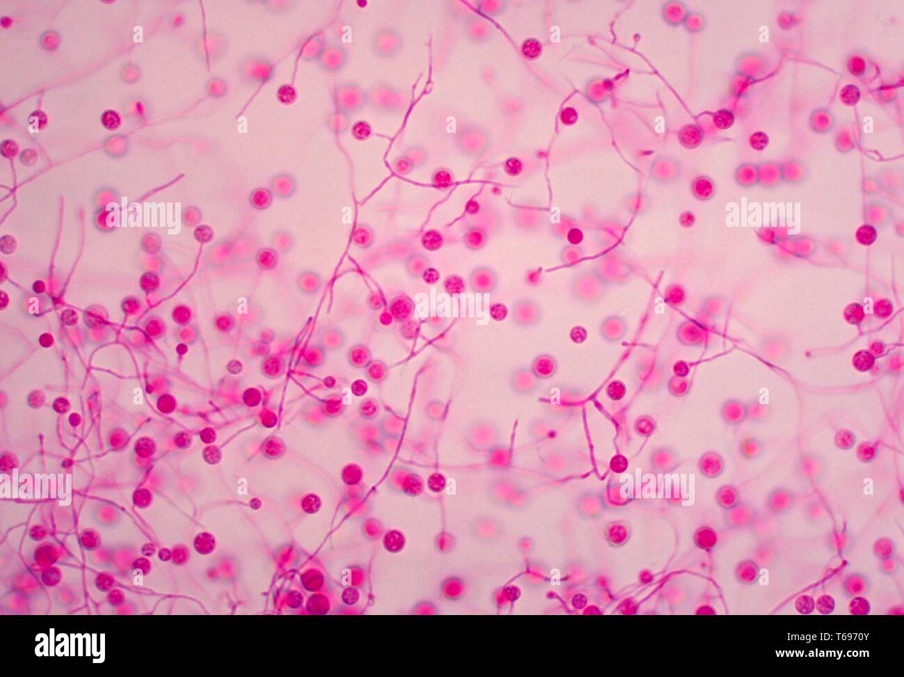 Photomicrograph der Jamaikanischen isolieren glatte macroconidia der dimorphic Pilz Histoplasma capsulatum, 1968. Bild mit freundlicher Genehmigung Zentren für Krankheitskontrolle und Prävention (CDC)/Dr Libero Ajello. () Stockfoto