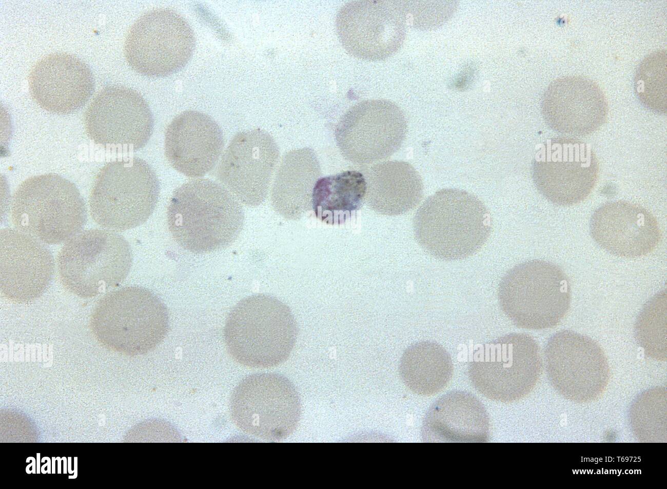 Thin Film photomicrograph eines reifen Plasmodium malariae trophozoite, ähnelt einem macrogametocyte, 1965. Bild mit freundlicher Genehmigung Zentren für Krankheitskontrolle und Prävention (CDC)/Dr Mae Melvin. () Stockfoto