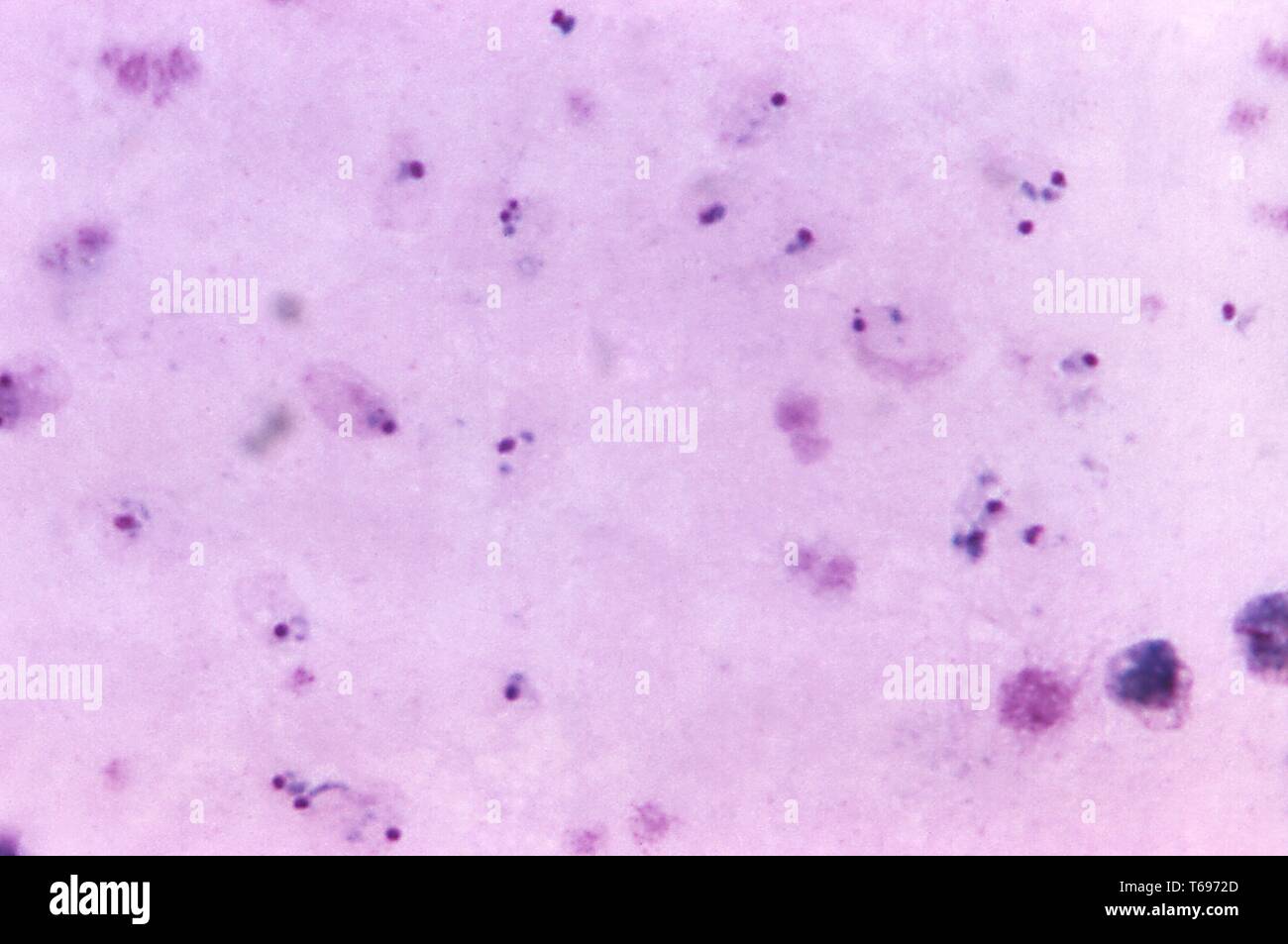 Giemsa Fleck Thick Film photomicrograph eines Plasmodium vivax Ringe und eine alte trophozoite, 1971. Bild mit freundlicher Genehmigung Zentren für Krankheitskontrolle und Prävention (CDC)/Dr Mae Melvin. () Stockfoto