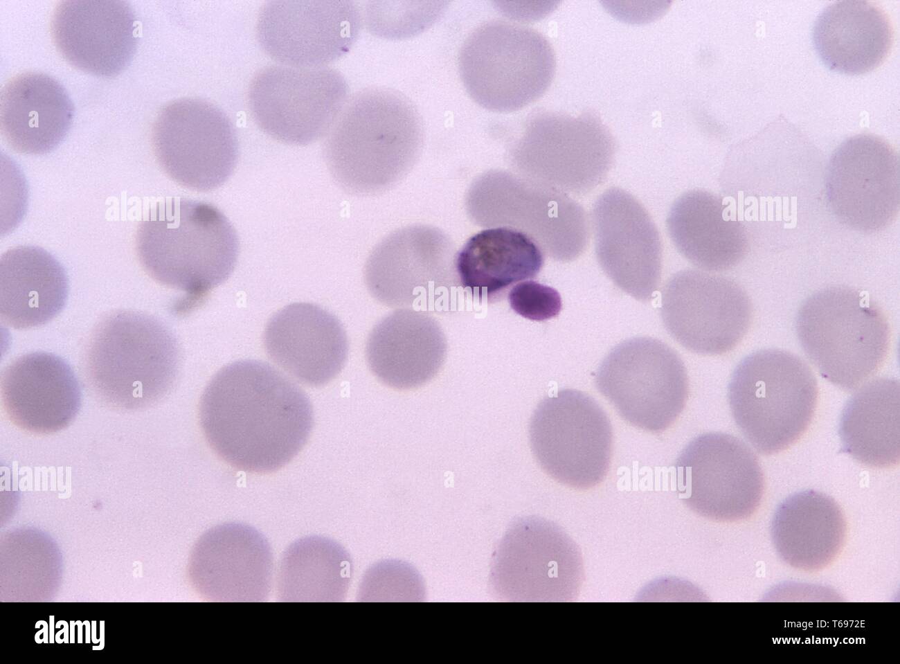 Giemsa Fleck thin film photomicrograph eines reifen Plasmodium malariae trophozoite, 1971. Bild mit freundlicher Genehmigung Zentren für Krankheitskontrolle und Prävention (CDC)/Dr Mae Melvin. () Stockfoto
