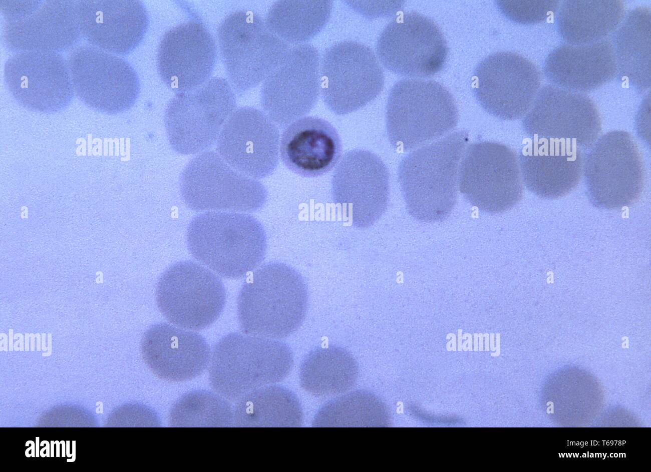 Thin Film Schliffbild einer wachsenden, abgerundete Plasmodium malariae trophozoite innerhalb eines etwas kleiner als normale rote Blutkörperchen, 1965. Bild mit freundlicher Genehmigung von CDC/Dr. Mae Melvin. () Stockfoto