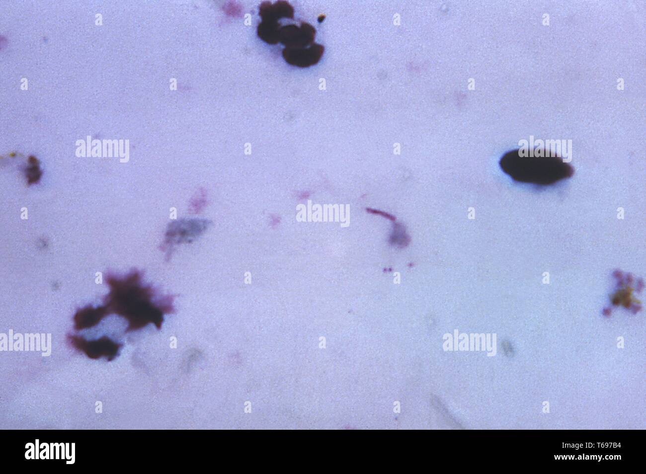 Dickschicht photomicrograph eines Plasmodium malariae Parasiten und eine artifactual Bazillus Bakterium, 1965. Bild mit freundlicher Genehmigung Zentren für Krankheitskontrolle und Prävention (CDC)/Dr Mae Melvin. () Stockfoto