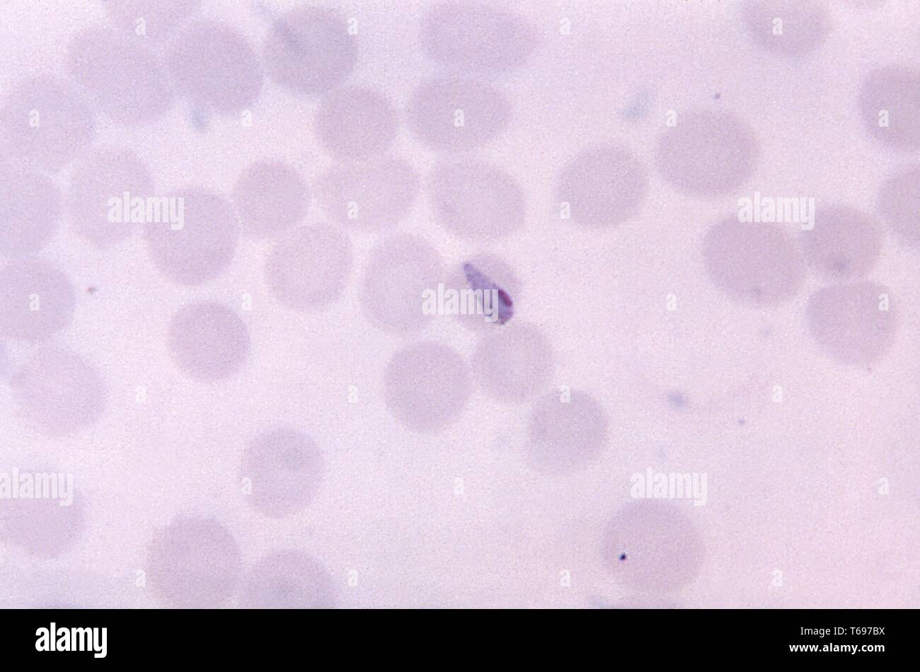 Thin Film photomicrograph eines wachsenden Plasmodium malariae bond Form trophozoite, 1966. Bild mit freundlicher Genehmigung Zentren für Krankheitskontrolle und Prävention (CDC)/Dr Mae Melvin. () Stockfoto