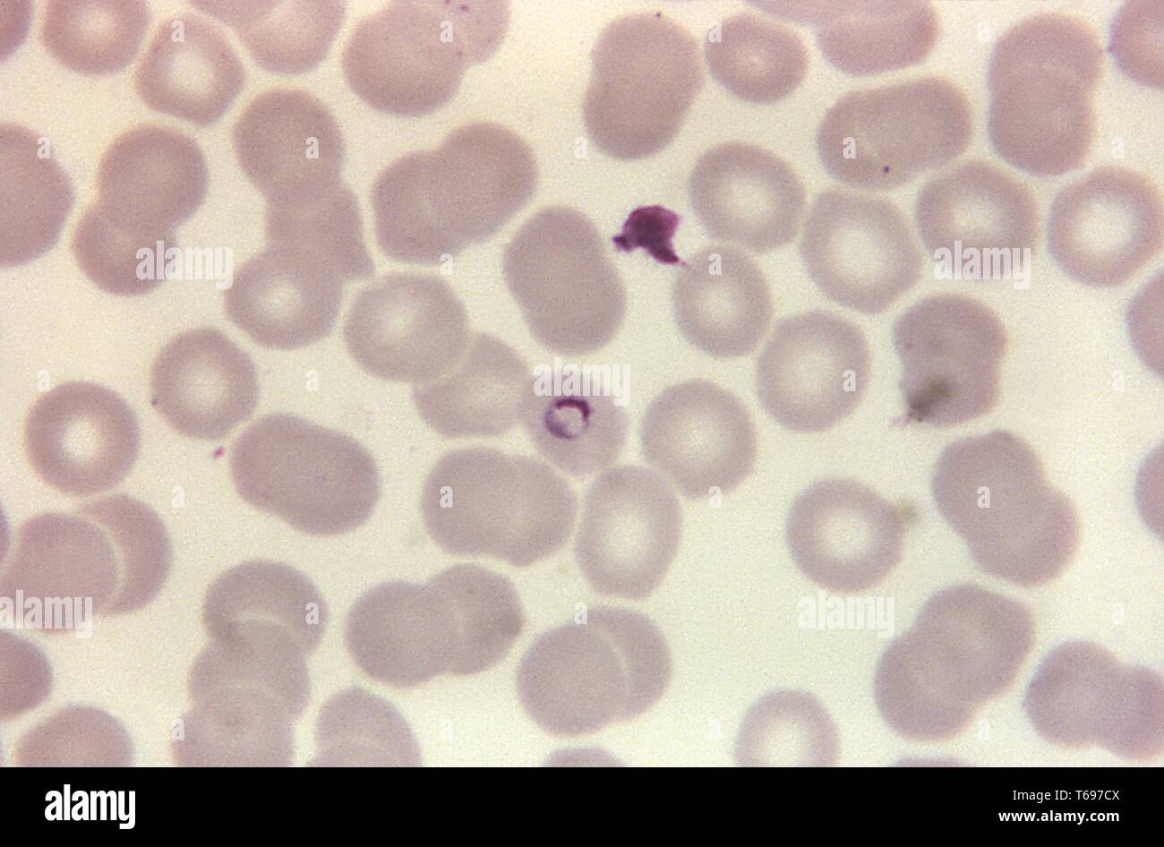 Giemsa Fleck thin film photomicrograph eines Plasmodium malariae Ring, 1971. Bild mit freundlicher Genehmigung Zentren für Krankheitskontrolle und Prävention (CDC)/Dr Mae Melvin. () Stockfoto