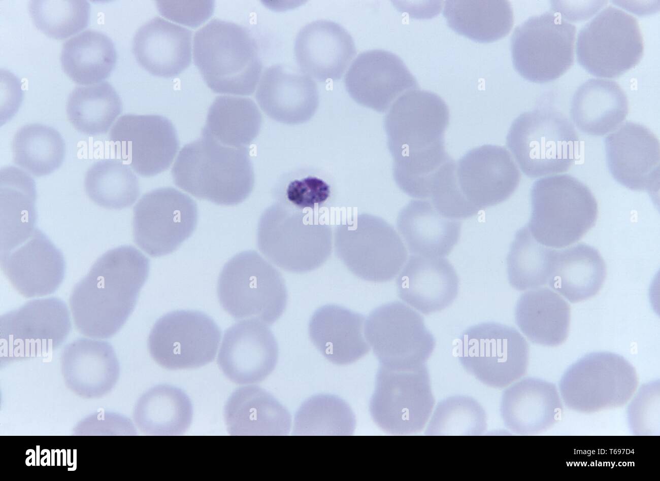 Giemsa Fleck photomicrograph eines kompakten Plasmodium malariae trophozoite, 1973. Bild mit freundlicher Genehmigung Zentren für Krankheitskontrolle und Prävention (CDC)/Dr Mae Melvin. () Stockfoto