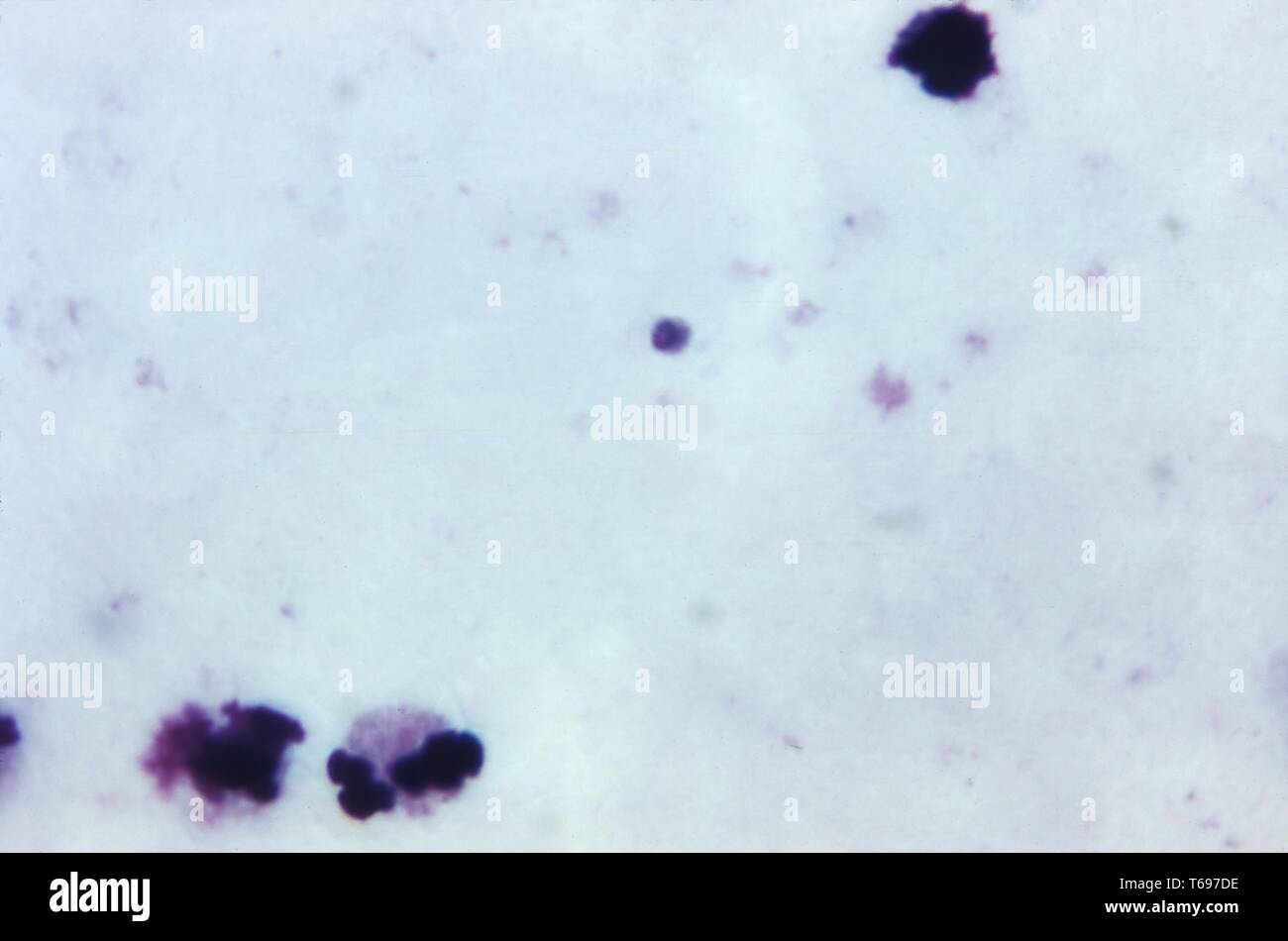 Giemsa Fleck Thick Film photomicrograph eines wachsenden Plasmodium malariae trophozoite, 1973. Bild mit freundlicher Genehmigung Zentren für Krankheitskontrolle und Prävention (CDC)/Dr Mae Melvin. () Stockfoto