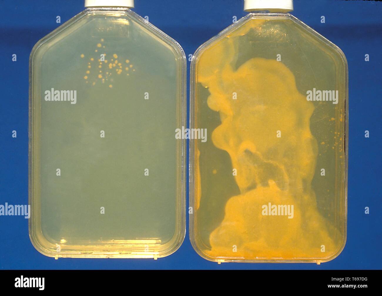 Zwei Histoplasma capsulatum Muster Kulturen, die Links korrekt mit der konzentrierten Sputum Probe und rechts mit Nichtkonzentriertes Sputum, 1979 geimpft geimpft. Bild mit freundlicher Genehmigung von CDC/Dr. Lenore Haley. () Stockfoto