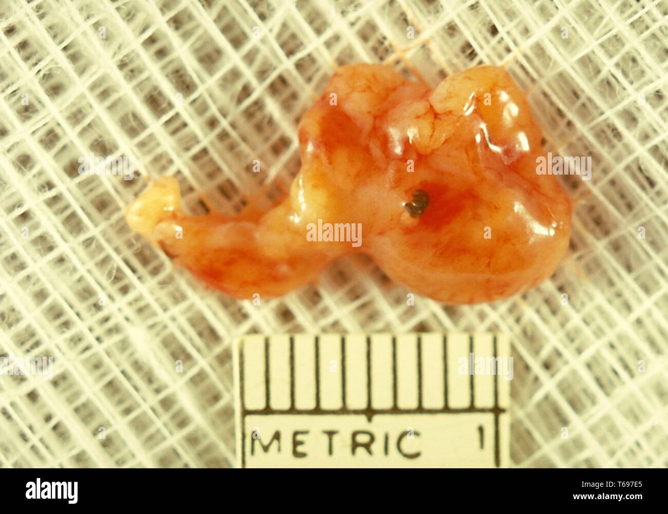 Schwarzes getreide myzetom Fotos und Bildmaterial in hoher Auflösung