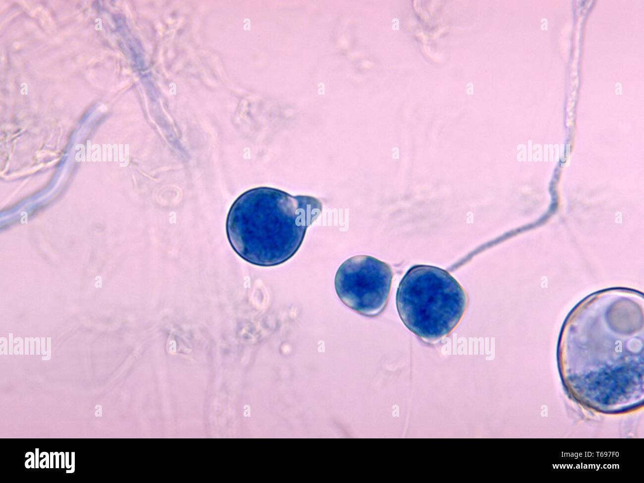 Photomicrograph des Pilzes Basidiobolus meristosporus, 1970. Bild mit freundlicher Genehmigung von CDC/Dr. Libero Ajello. () Stockfoto