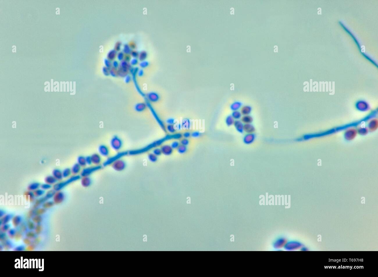 Der Photomicrograph conidiophores und die Konidien des Pilzes Sporothrix schenckii, 1972. Bild mit freundlicher Genehmigung Zentren für Krankheitskontrolle und Prävention (CDC)/Dr Libero Ajello. () Stockfoto