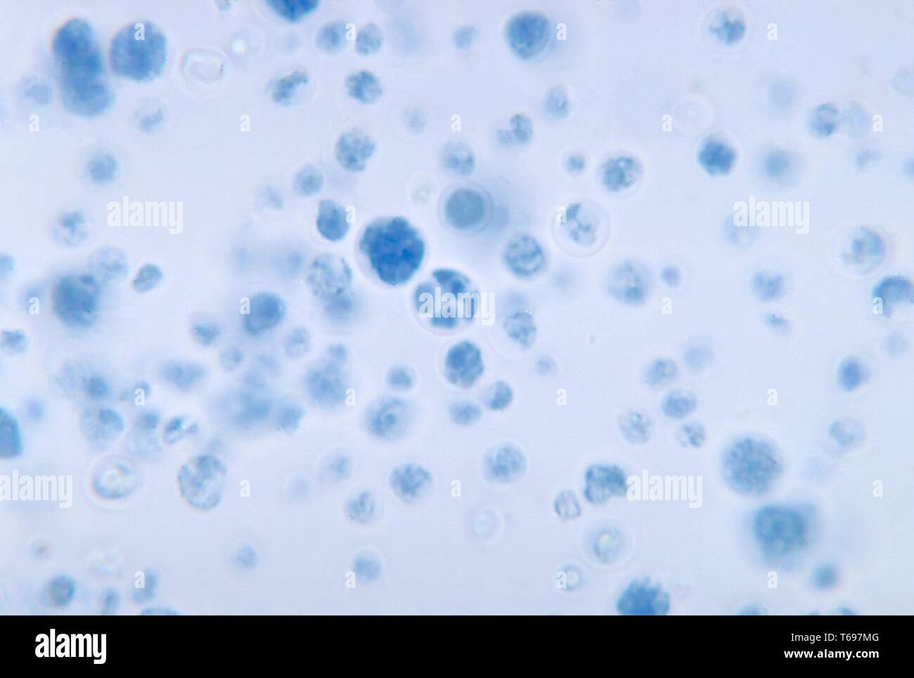 Der Photomicrograph achlorophyllic Algen Prototheca stagnora, 1972. Bild mit freundlicher Genehmigung Zentren für Krankheitskontrolle und Prävention (CDC)/Dr William Kaplan, Herr Sudman. () Stockfoto