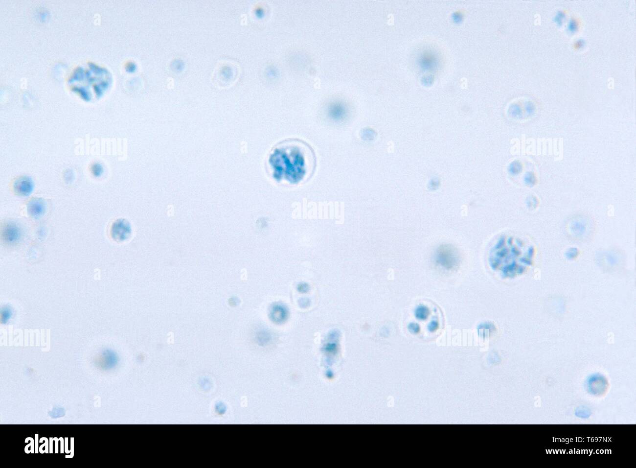 Lactophenol cotton Blue mount photomicrograph der allgegenwärtigen grünen Algen Prototheca wickerhamii, 1972. Bild mit freundlicher Genehmigung Zentren für Krankheitskontrolle und Prävention (CDC)/Dr William Kaplan, Herr Sudman. () Stockfoto