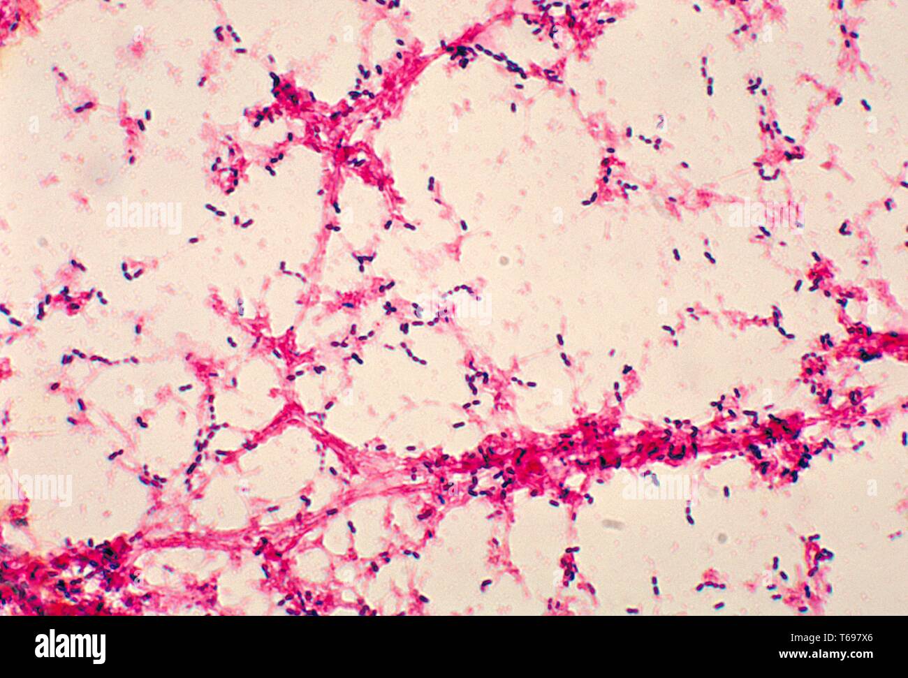 Dies ist ein photomicrograph von Streptococcus pneumoniae Bakterien aus einem Blut Kultur, 1978 angebaut worden. Streptococcus pneumoniae, die Bakterien verantwortlich für Pneumokokken Meningitis, ist sehr verbreitet, und in der Regel leben in der Rückseite der Nase und des Rachens oder der oberen Atemwege. Bild mit freundlicher Genehmigung von CDC/Dr. Mike Miller. Stockfoto