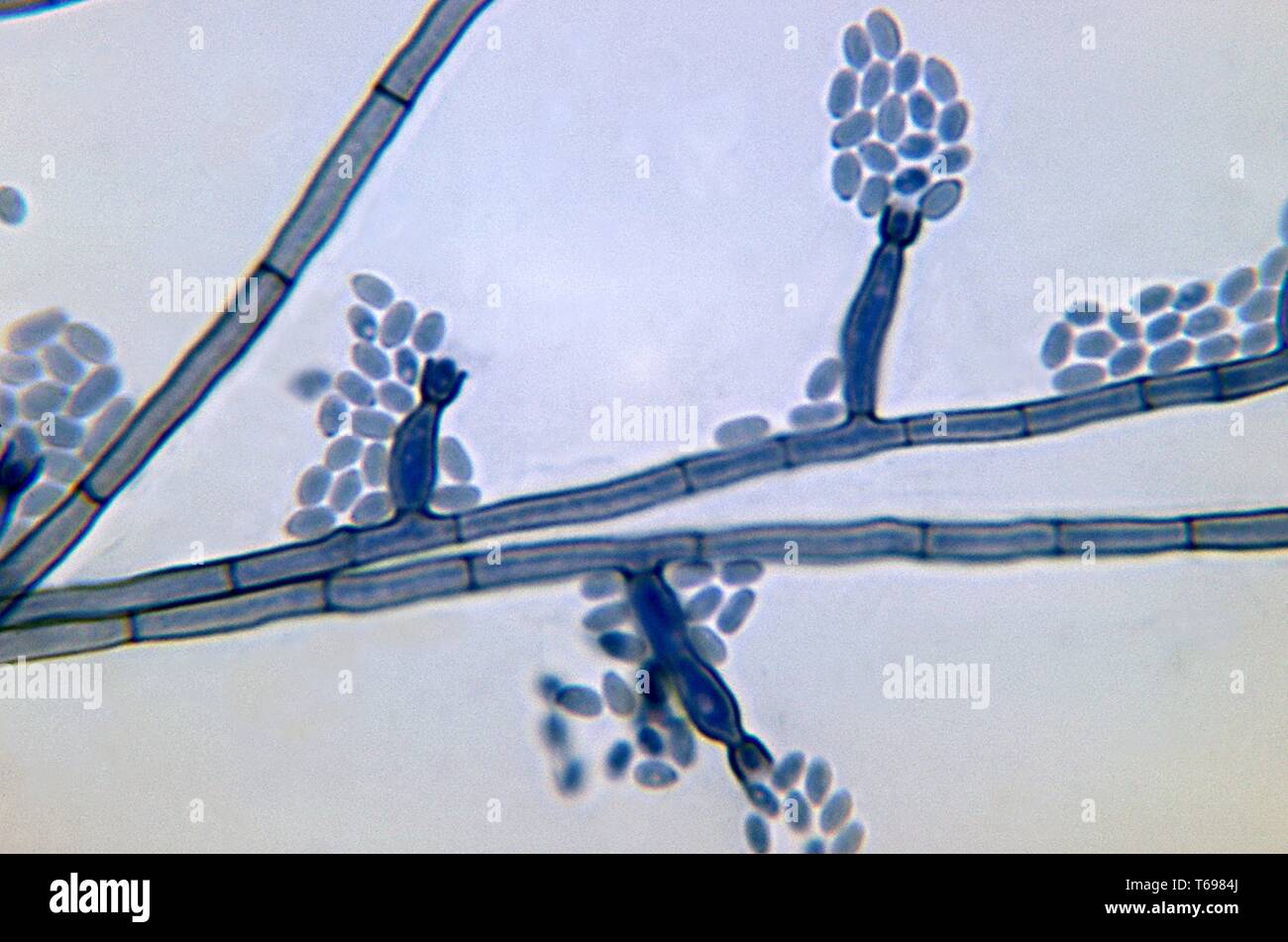 Photomicrograph der konidien-beladenen conidiophores des Phialophora verrucosa dematiaceous Pilz von einer Folie Kultur, 1972. Bild mit freundlicher Genehmigung Zentren für Krankheitskontrolle und Prävention (CDC)/Dr. Libero Ajello. () Stockfoto